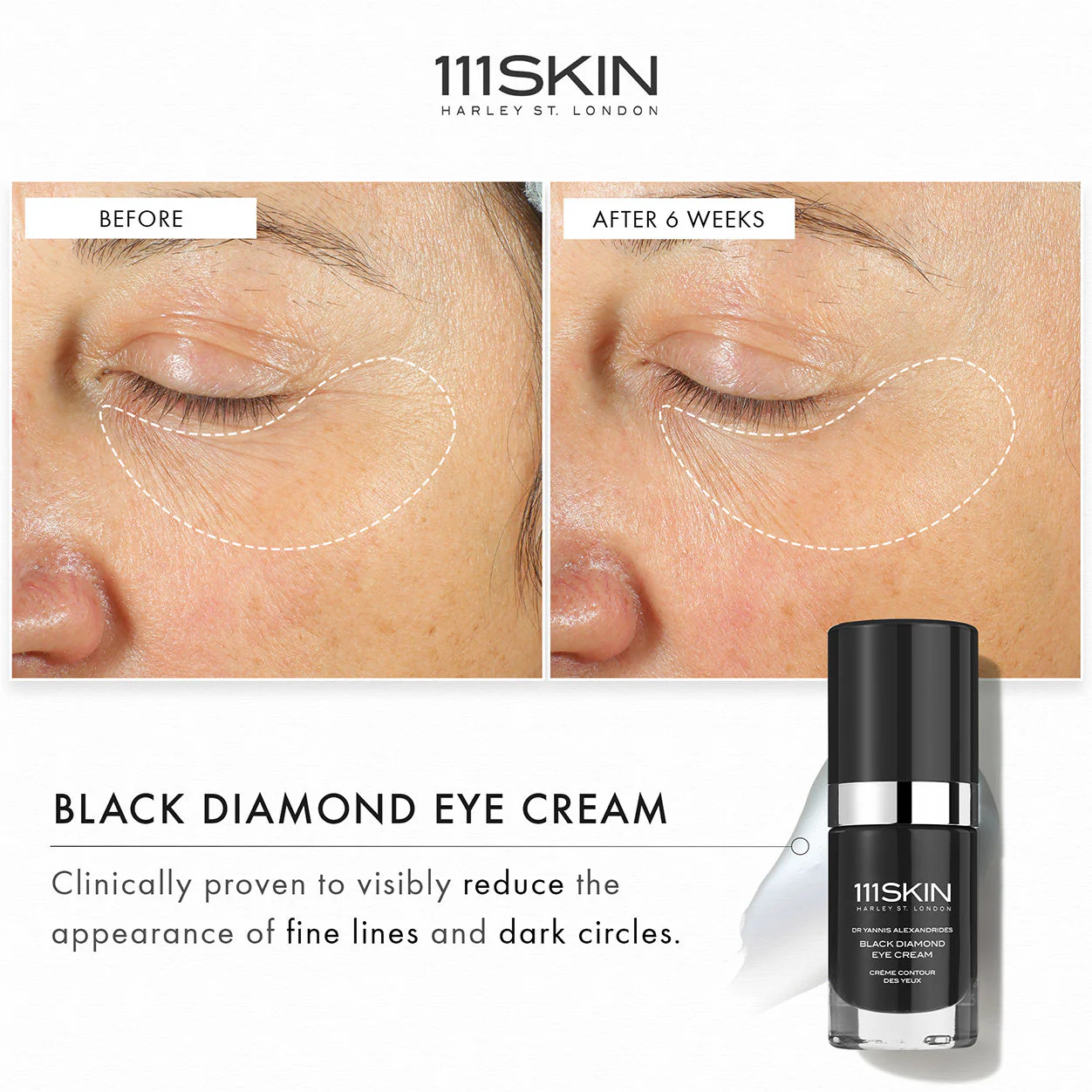 Black Diamond Eye Cream - Image 5
