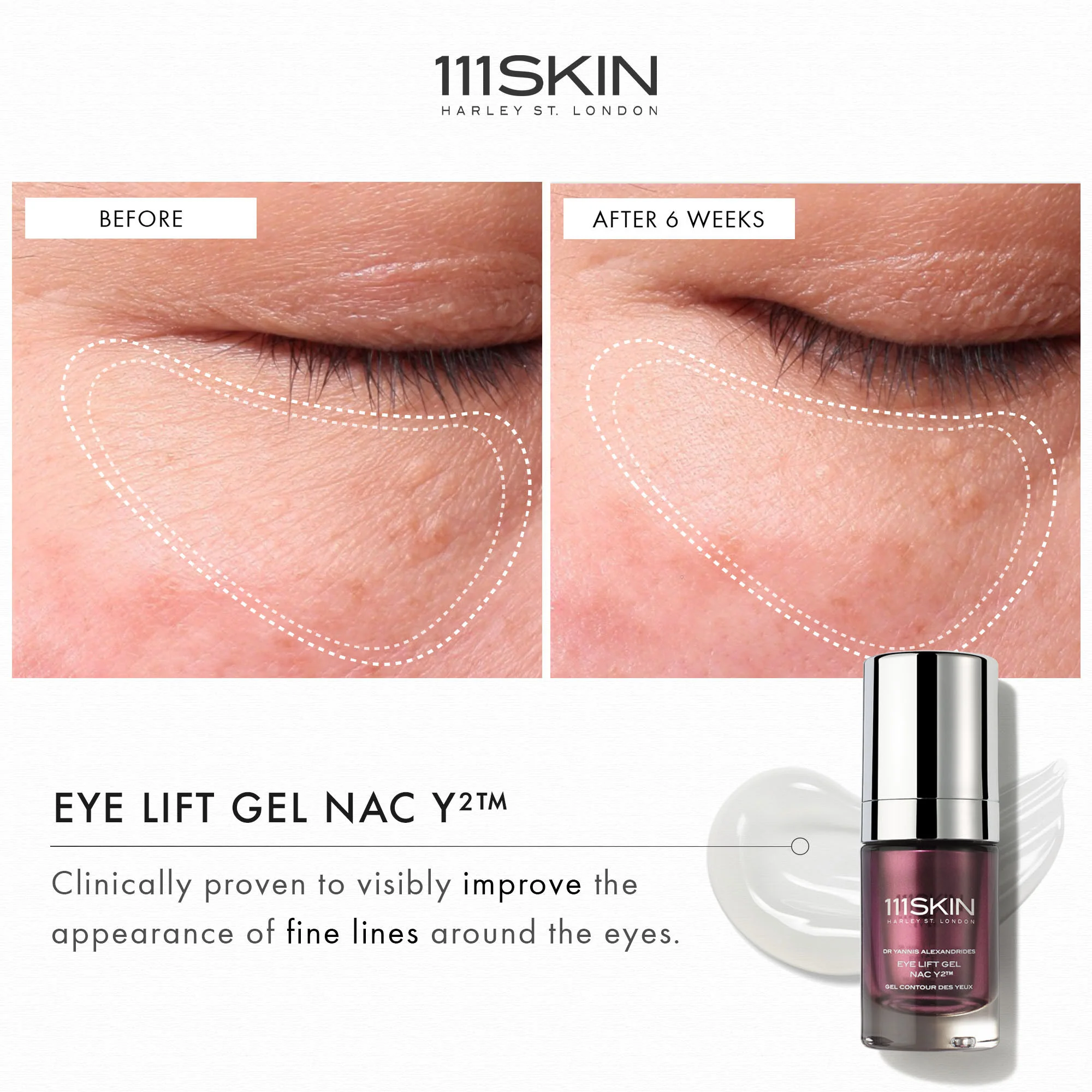 Eye Lift Gel NAC Y2 - Image 4