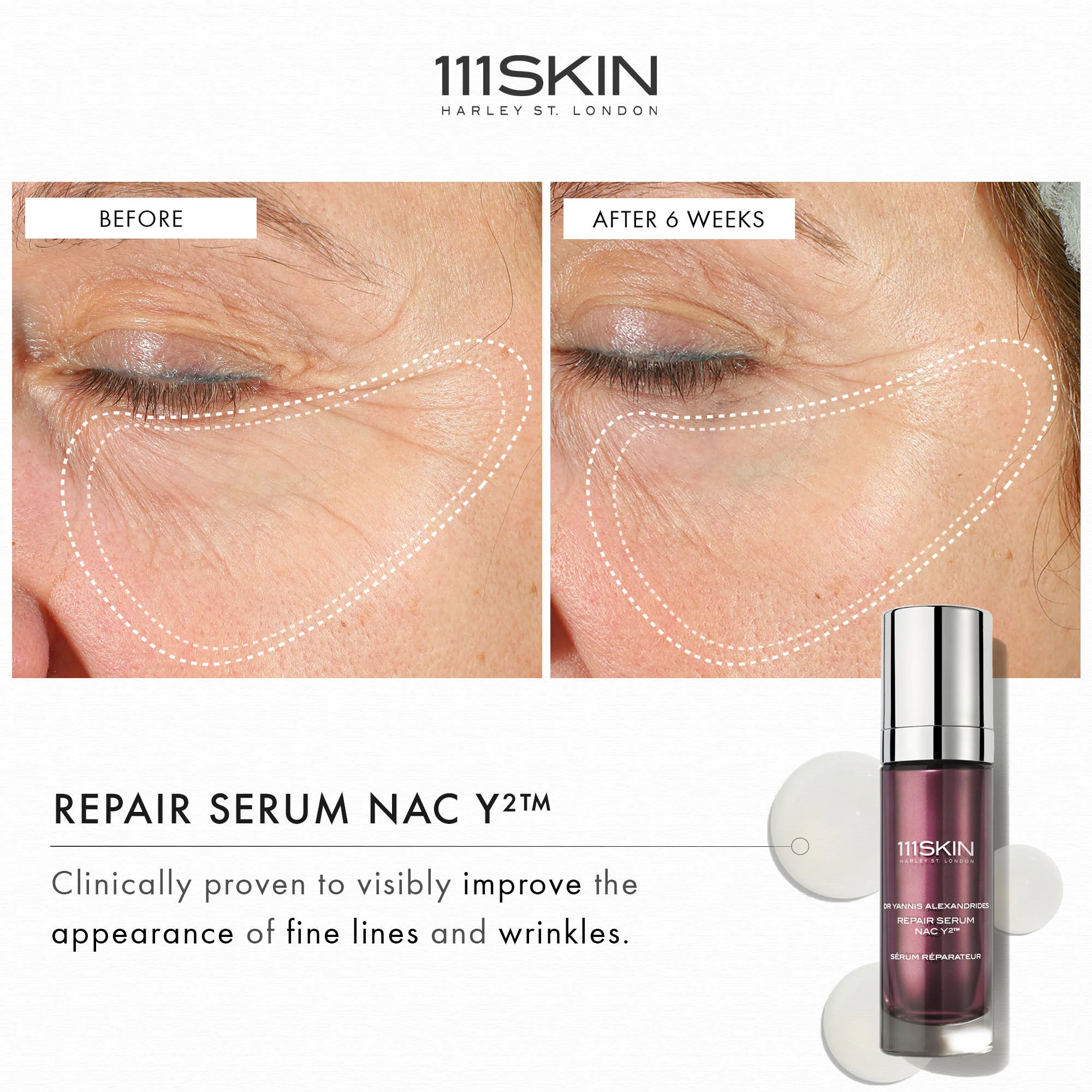 Repair Serum NAC Y2 - Image 5