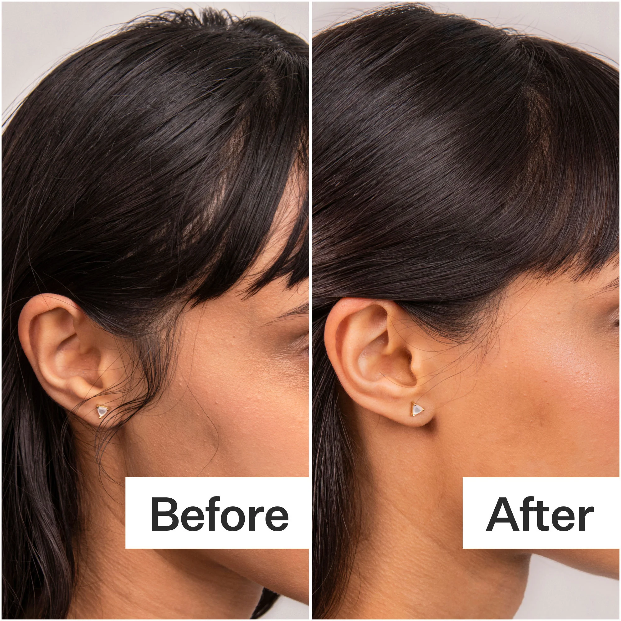 4% Niacinamide Oily Scalp Serum - Image 2