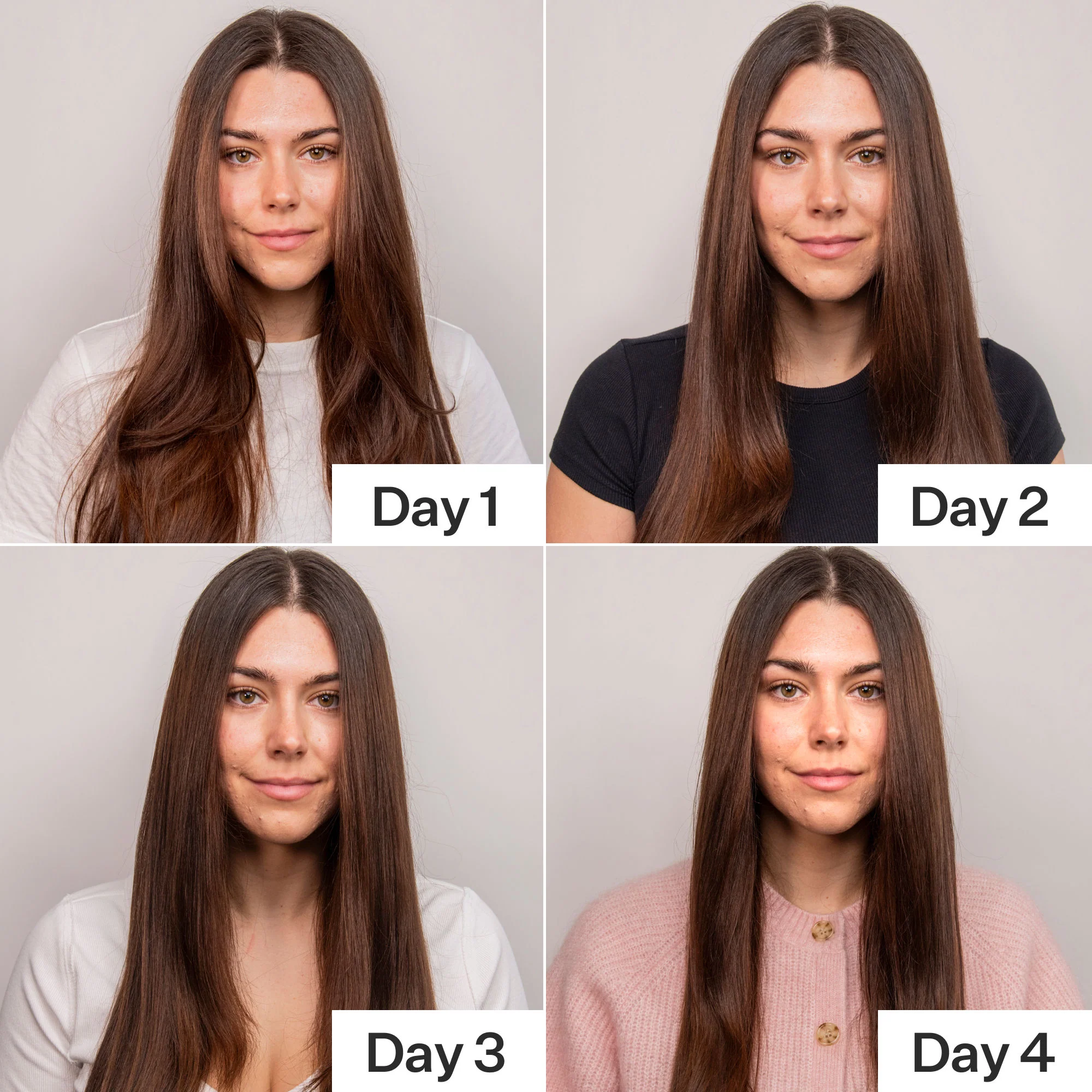 4% Niacinamide Oily Scalp Serum - Image 4