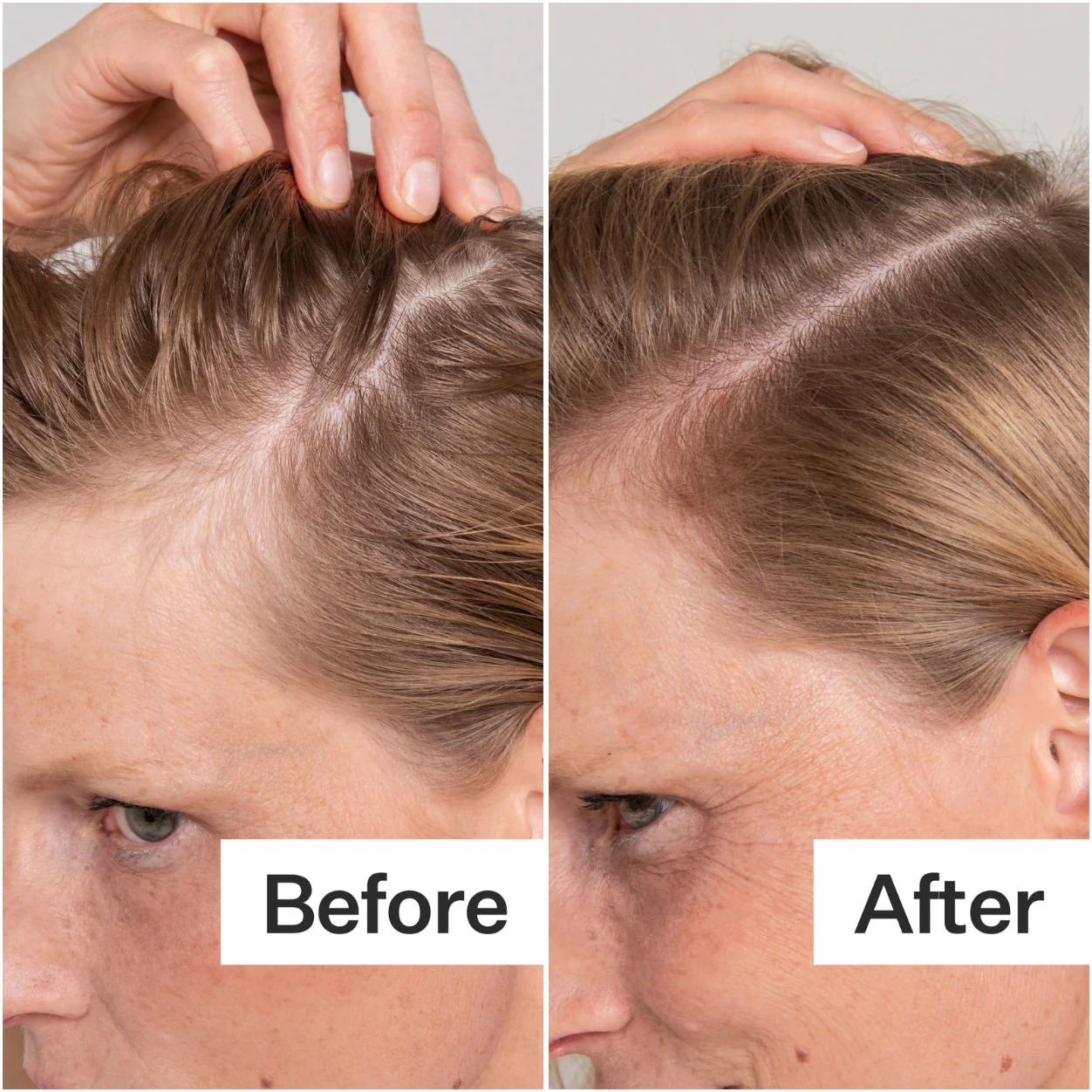 Salicylic Acid Scalp Exfoliator - Image 2