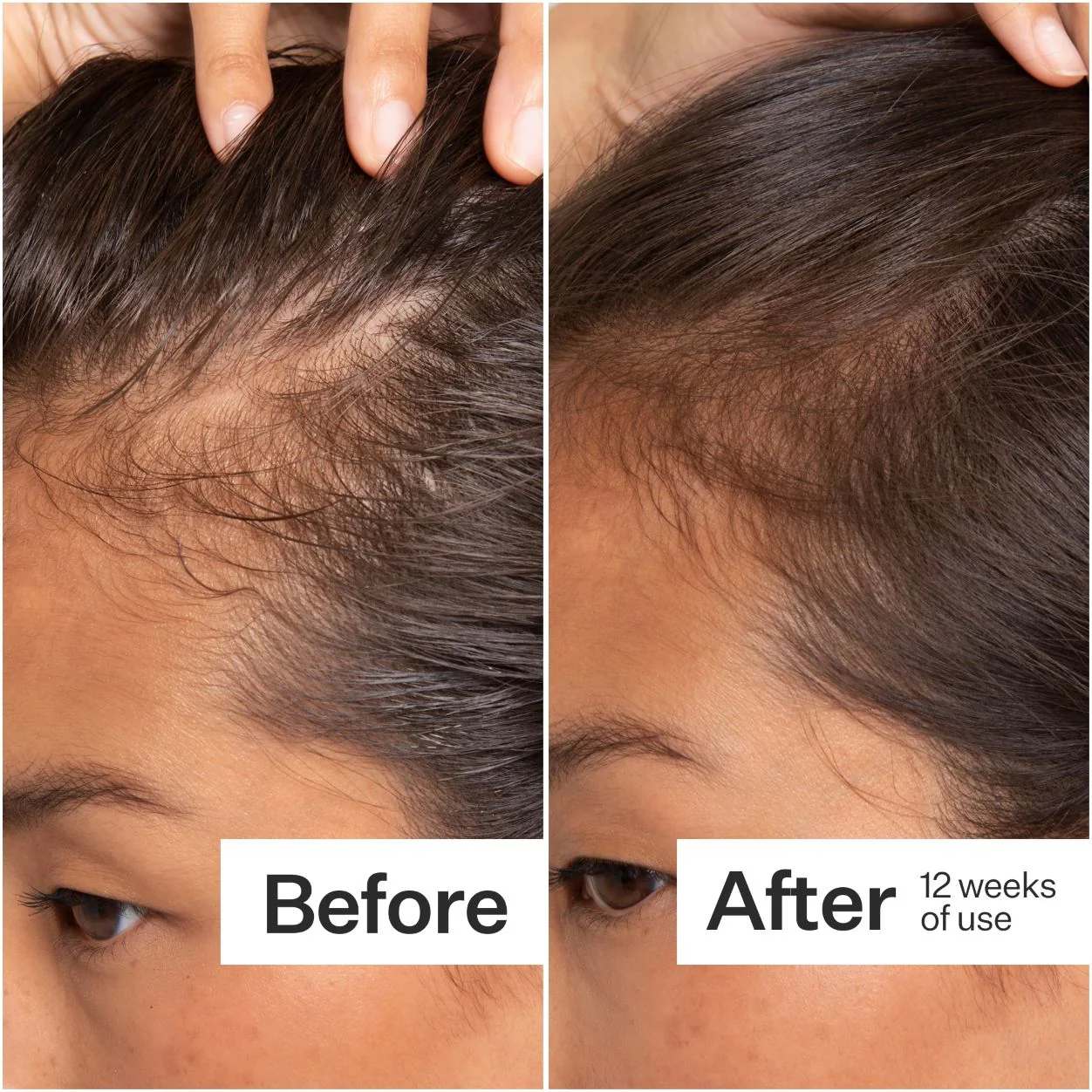 Cold Processed Stem Cell Serum - Image 5