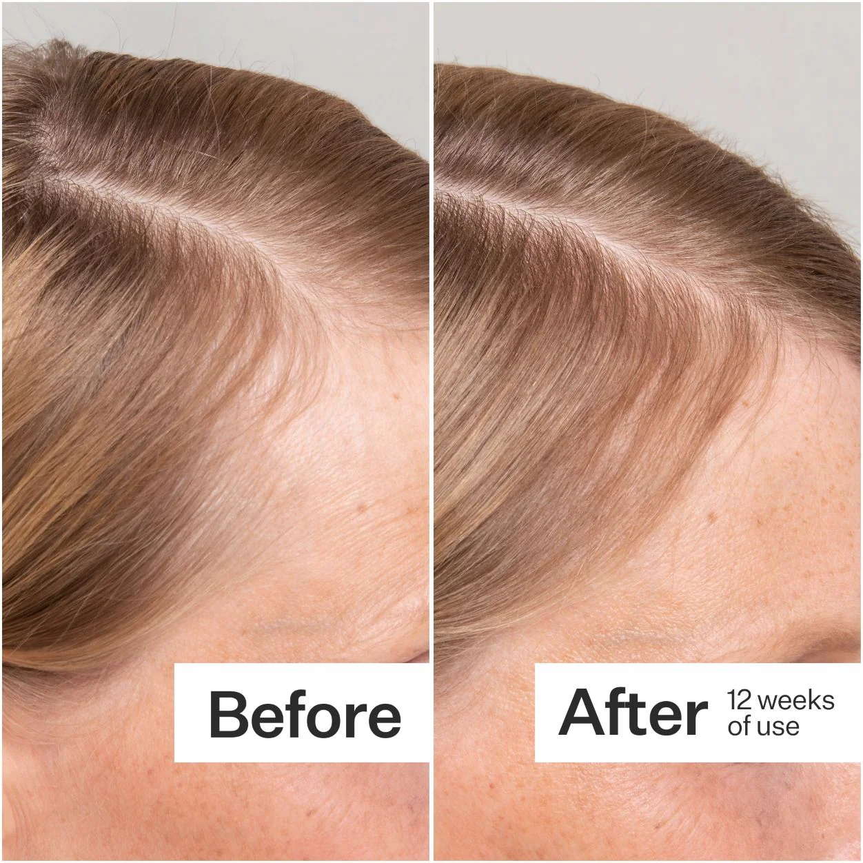 Cold Processed Stem Cell Serum - Image 6