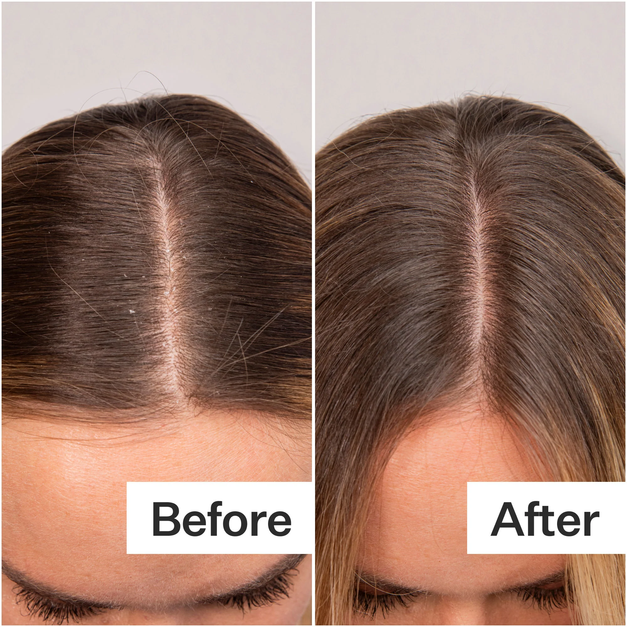 Daily Hydro Scalp Serum with Hyaluronic Acid for Dry Scalp - Image 4
