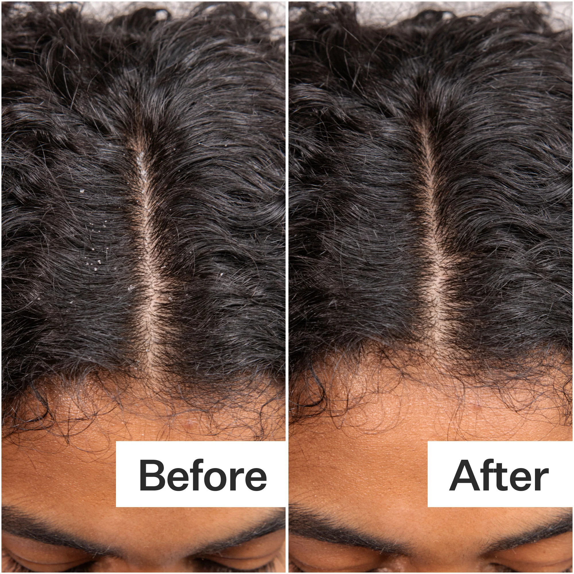 Daily Hydro Scalp Serum with Hyaluronic Acid for Dry Scalp - Image 5
