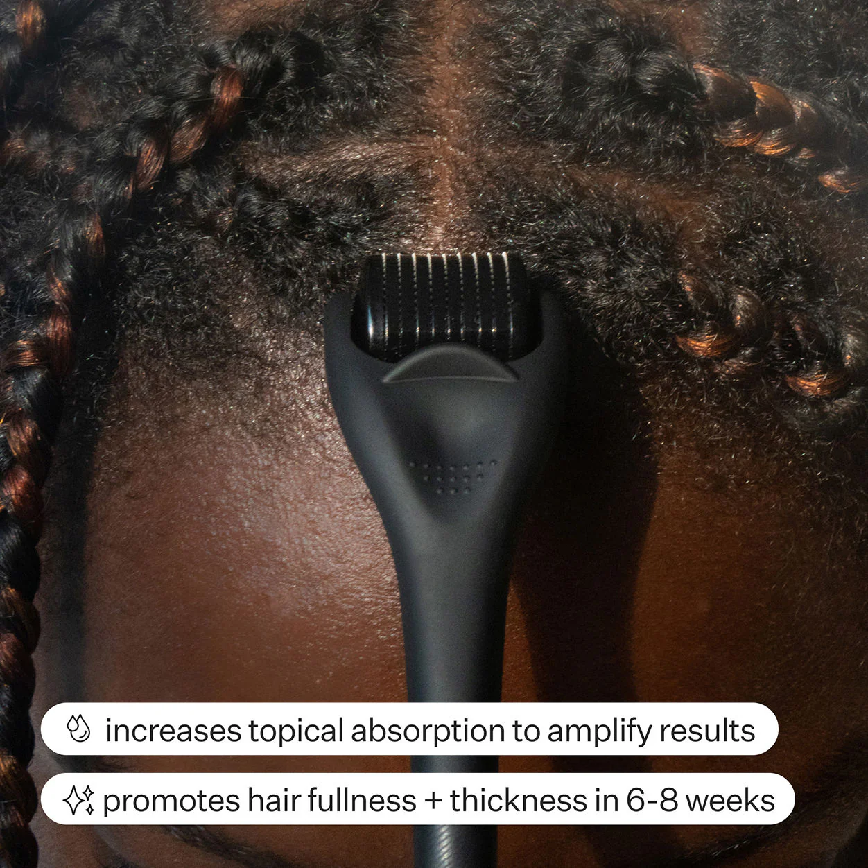 Dermaroller Hair System - Image 4