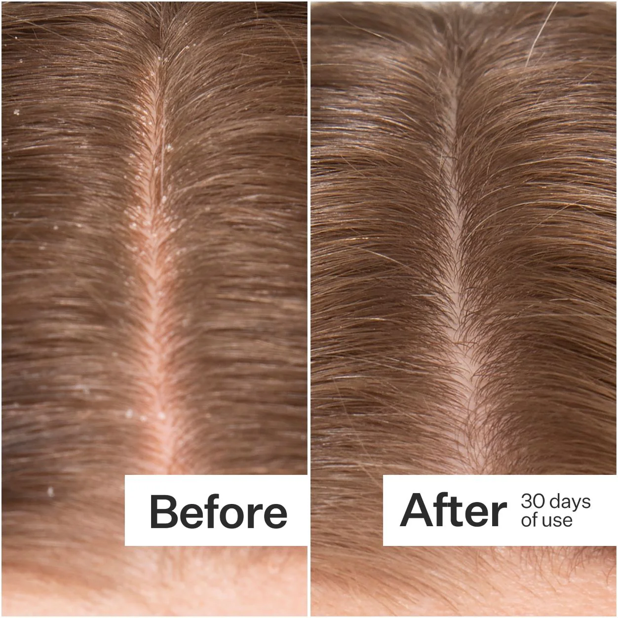 Microbiome Cooling Scalp Serum - Image 3