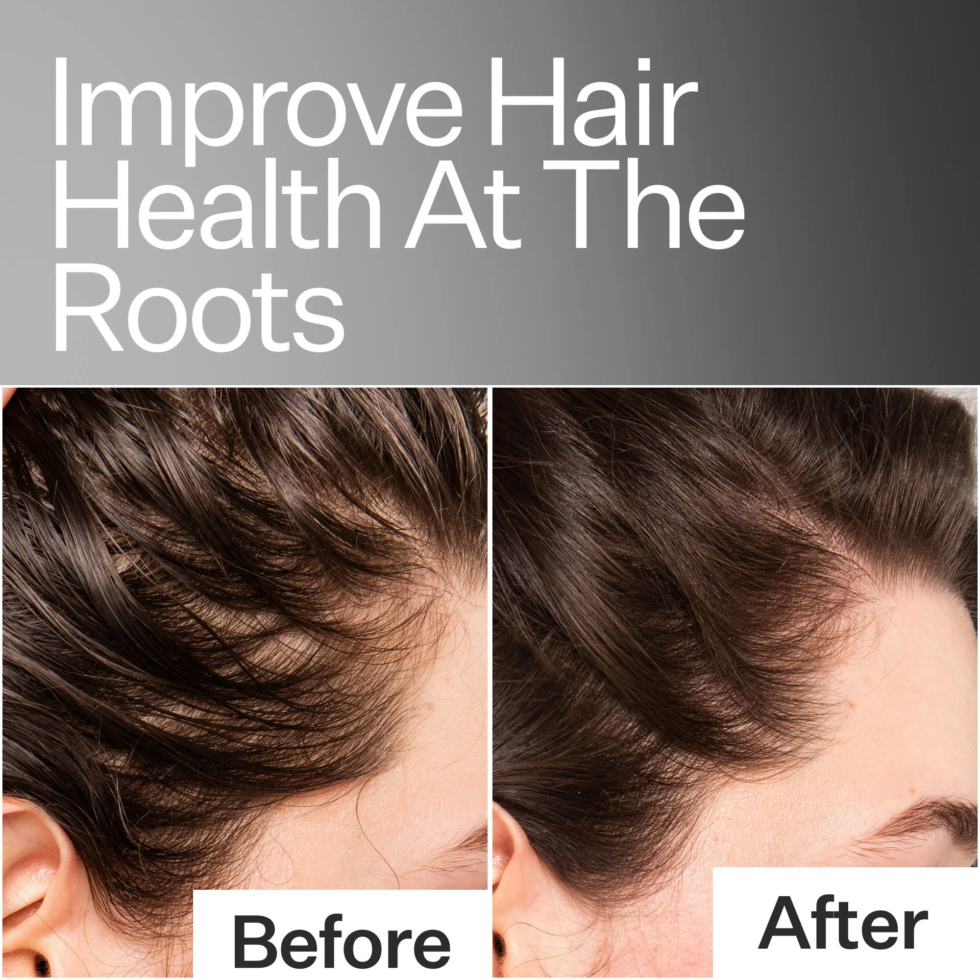 Scalp Relief System - Image 2