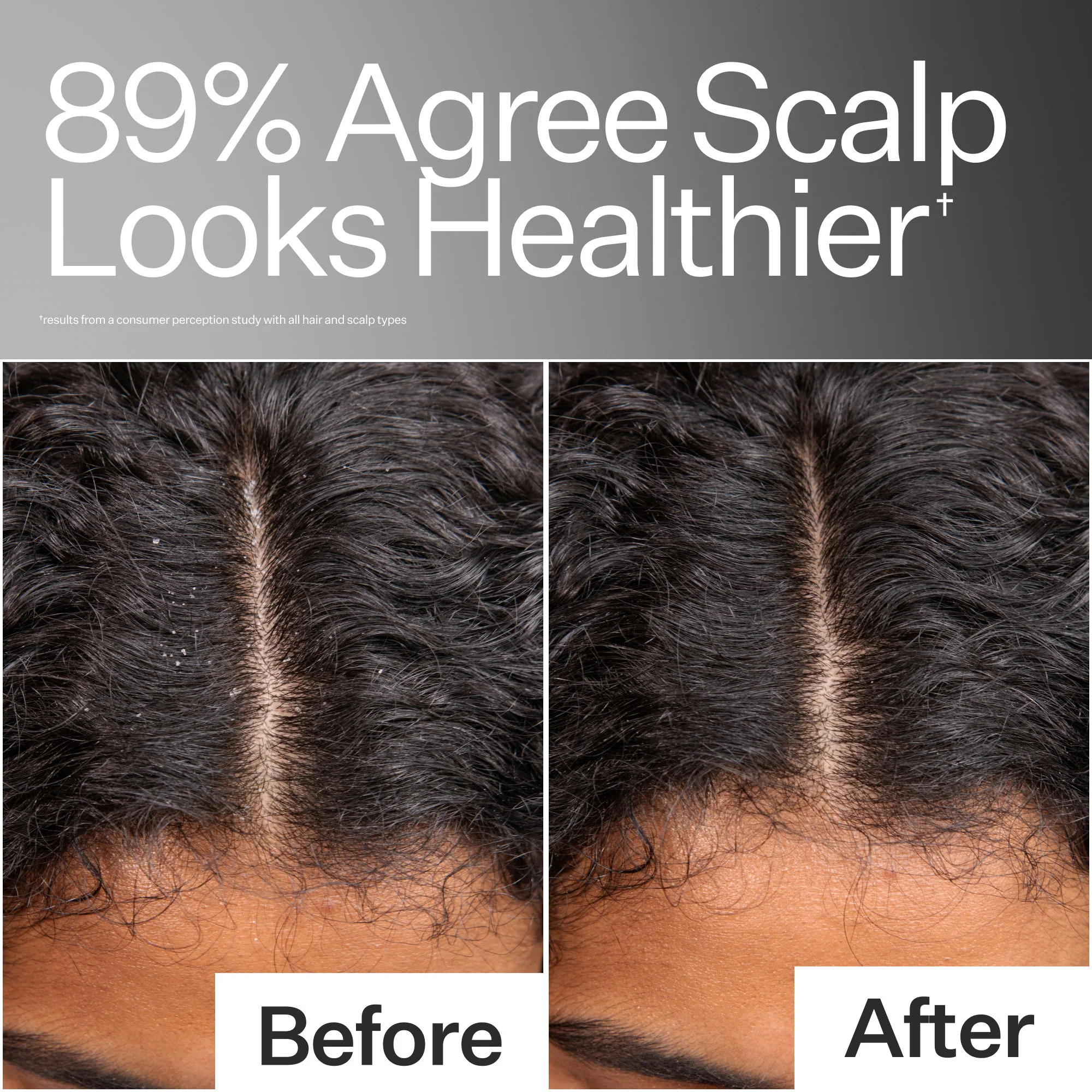 Scalp Relief System - Image 3