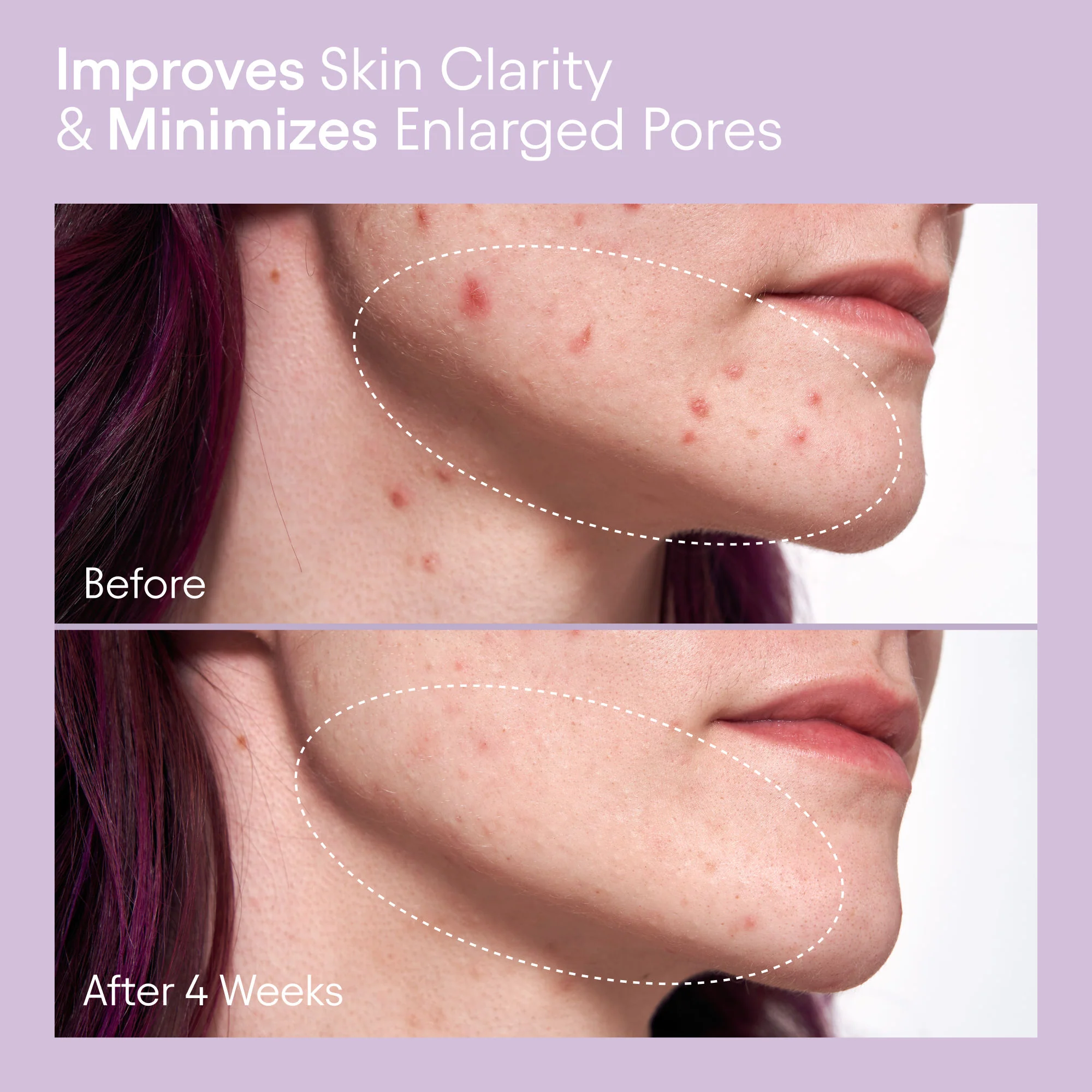 2% BHA Pore Perfecting Liquid Exfoliator for Brighter and Clearer Skin - Image 3