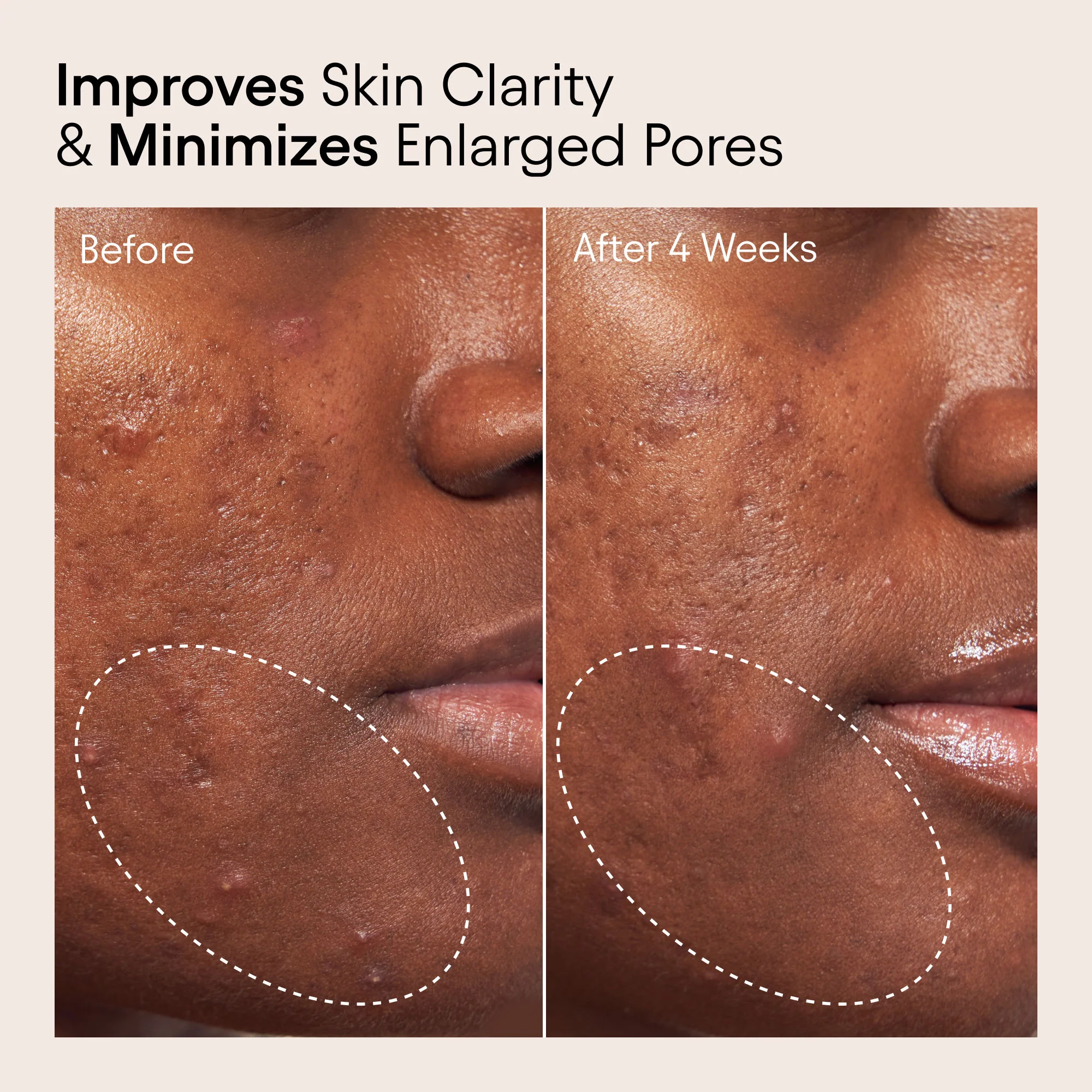 2% BHA Pore Perfecting Liquid Exfoliator for Brighter and Clearer Skin - Image 4