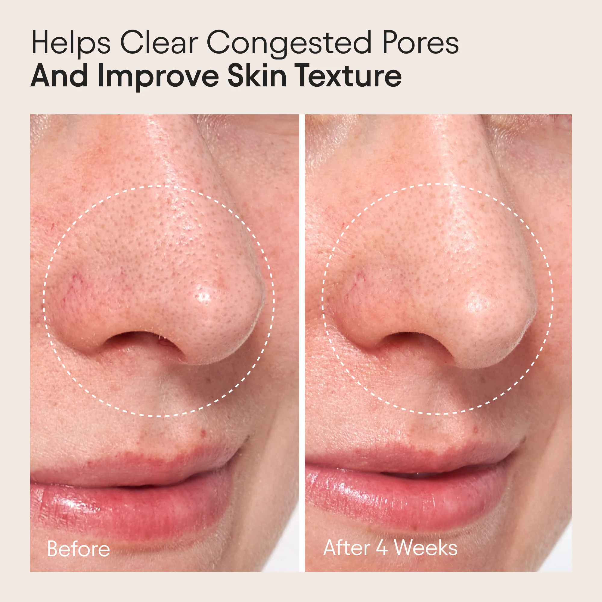 Clarifying Facial Oil with Retinol and Pink Algae - Image 3