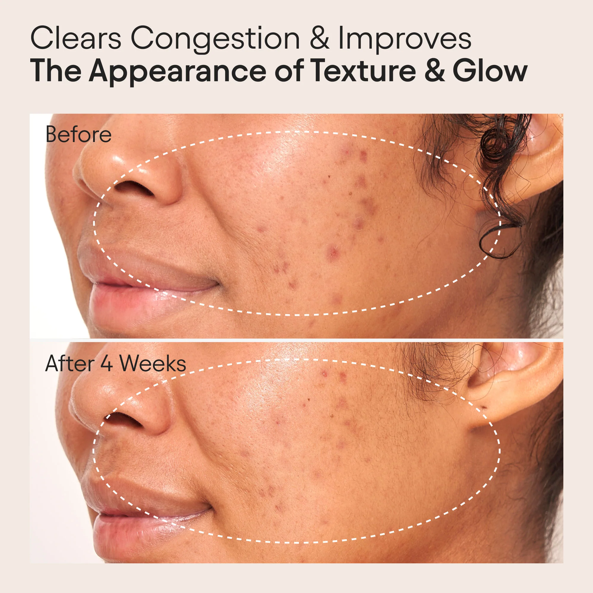 Clarifying Facial Oil with Retinol and Pink Algae - Image 4