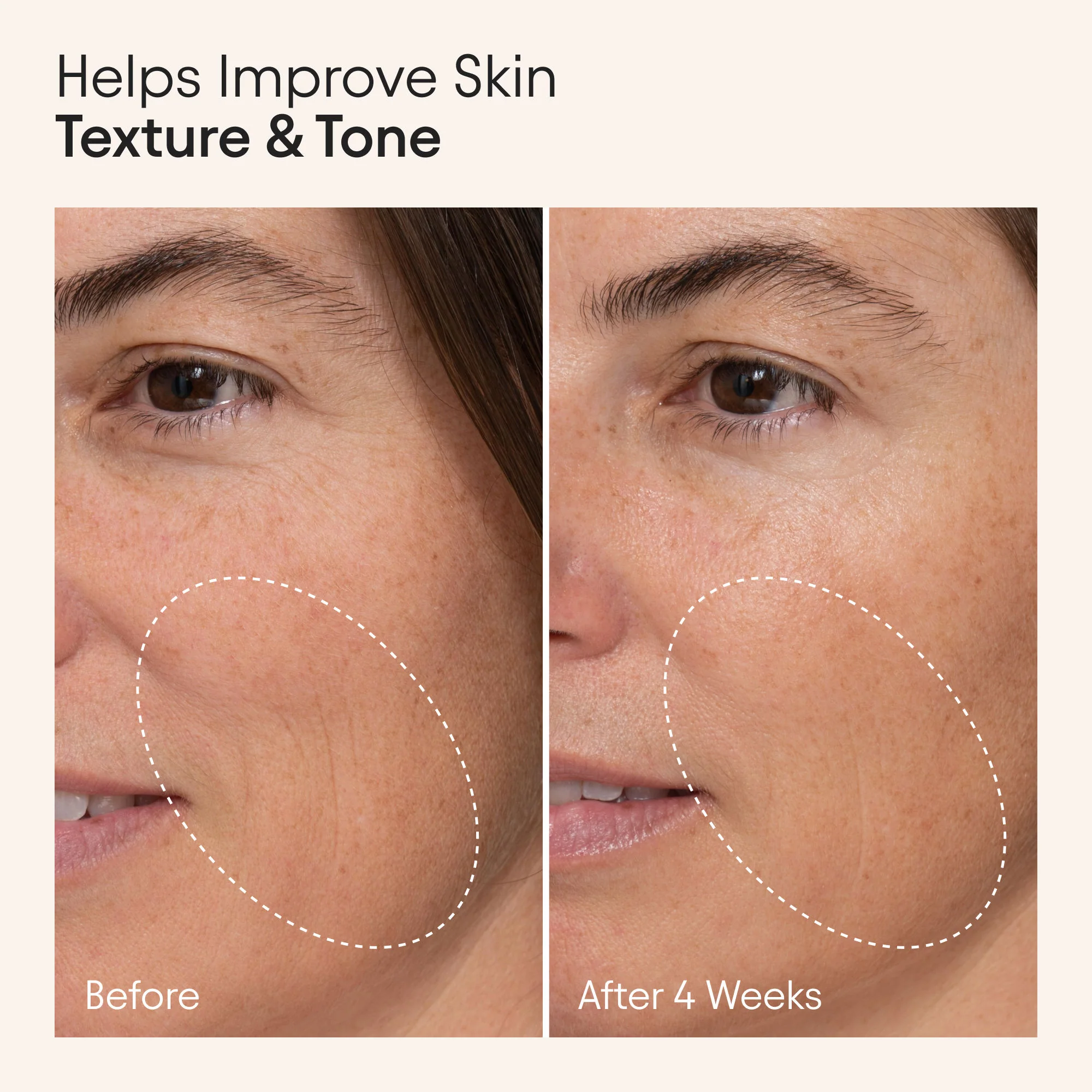 Hydrating Firming Serum with Niacinamide and Nettle - Image 2
