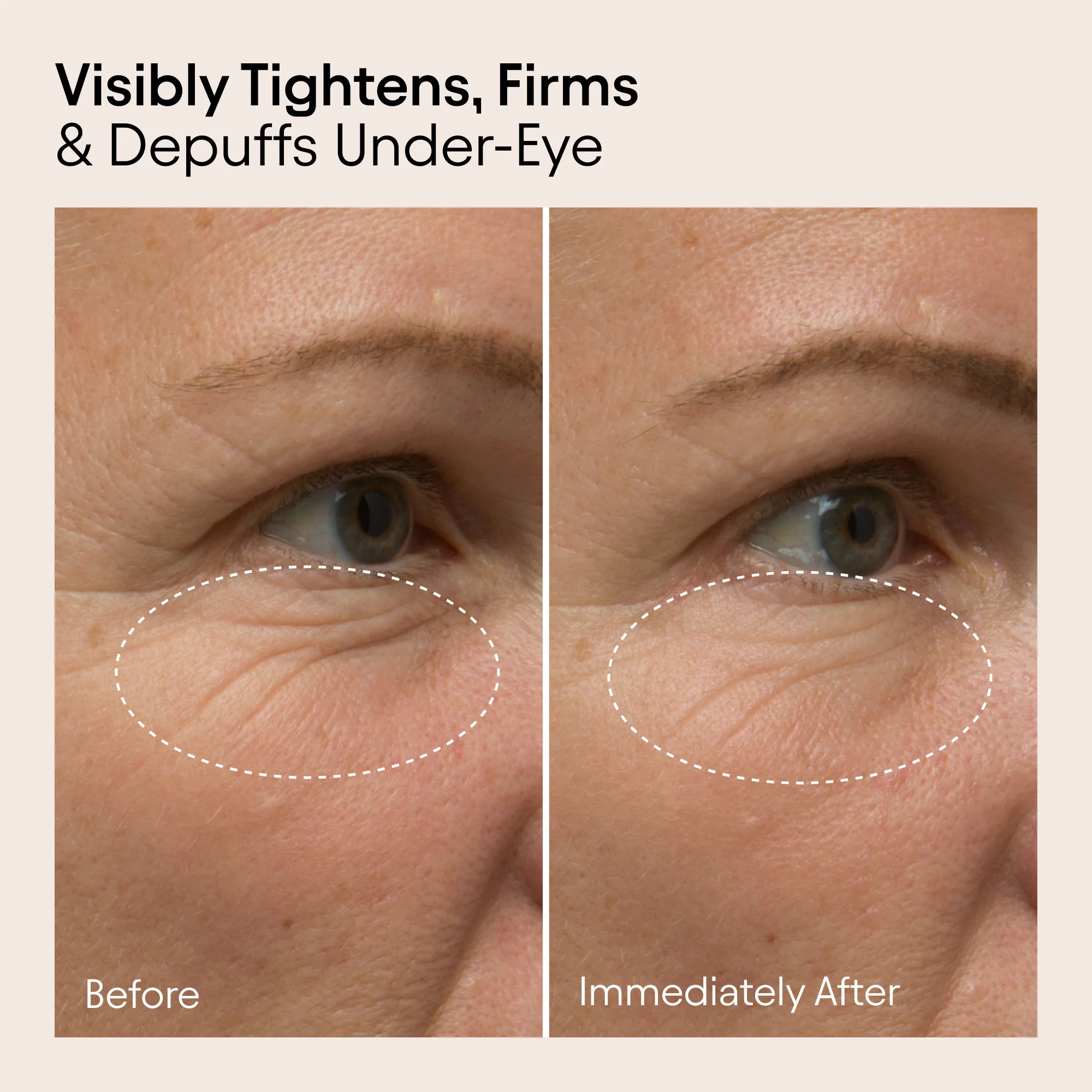 Line-Filling Eye Cream with Bakuchiol and Caffeine - Image 3