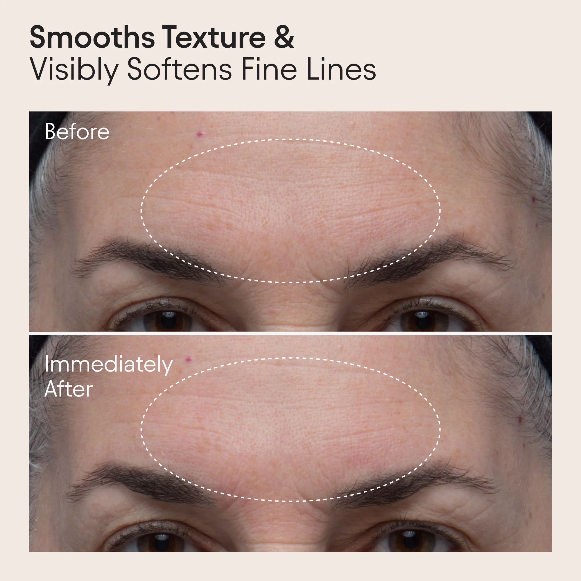 Polishing Peel and Brightening Face Mask with 8 Acids and Huckleberry - Image 3