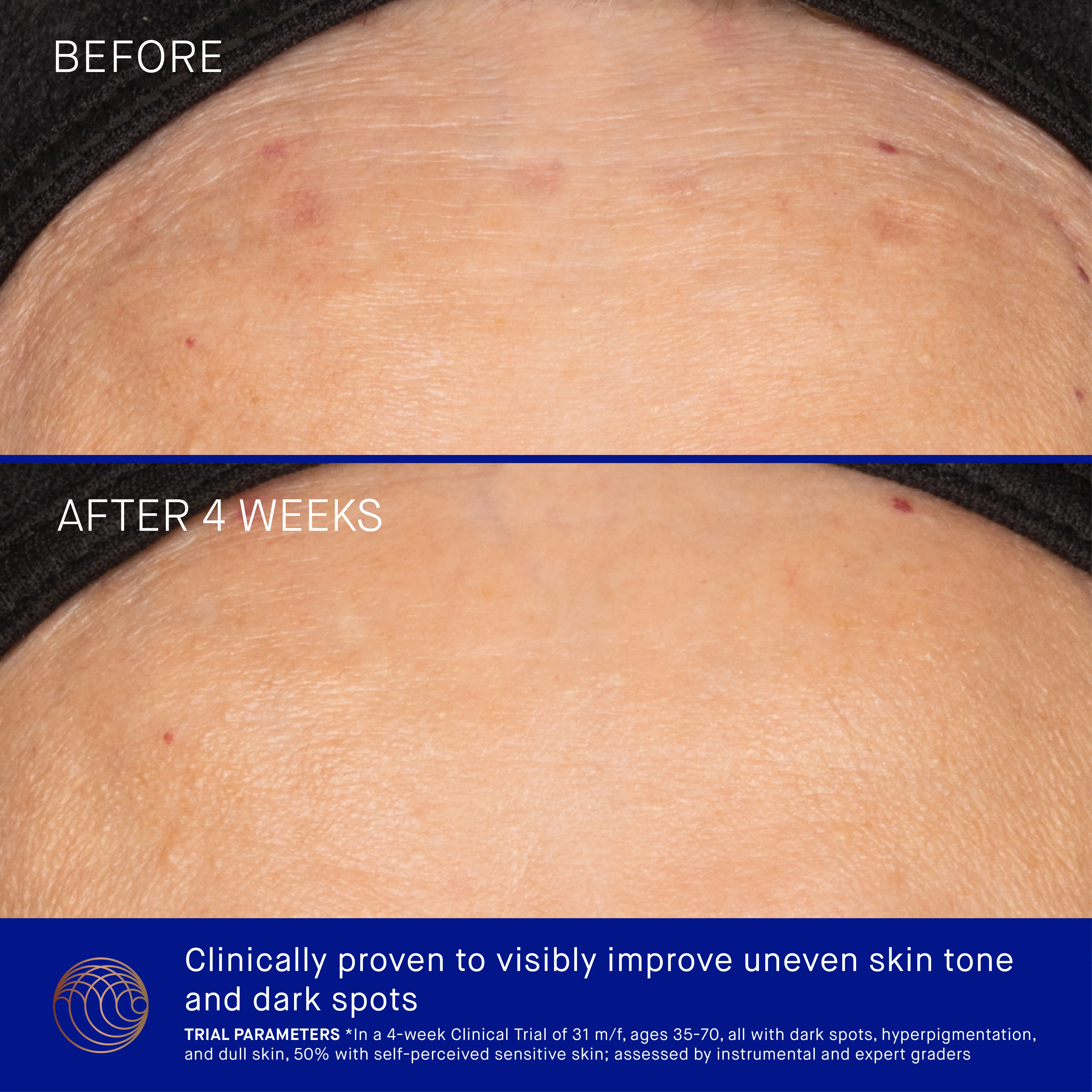 The Vitamin C Serum - Image 4