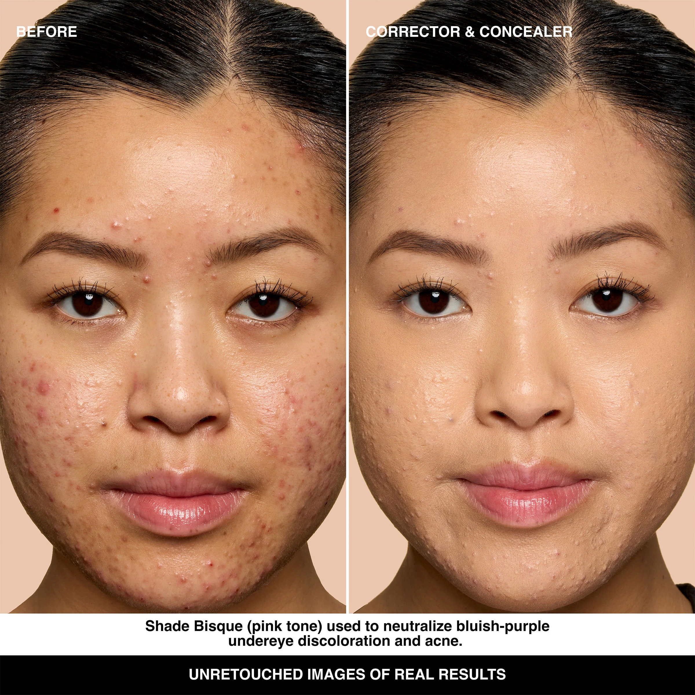 Skin Corrector Stick - Image 48