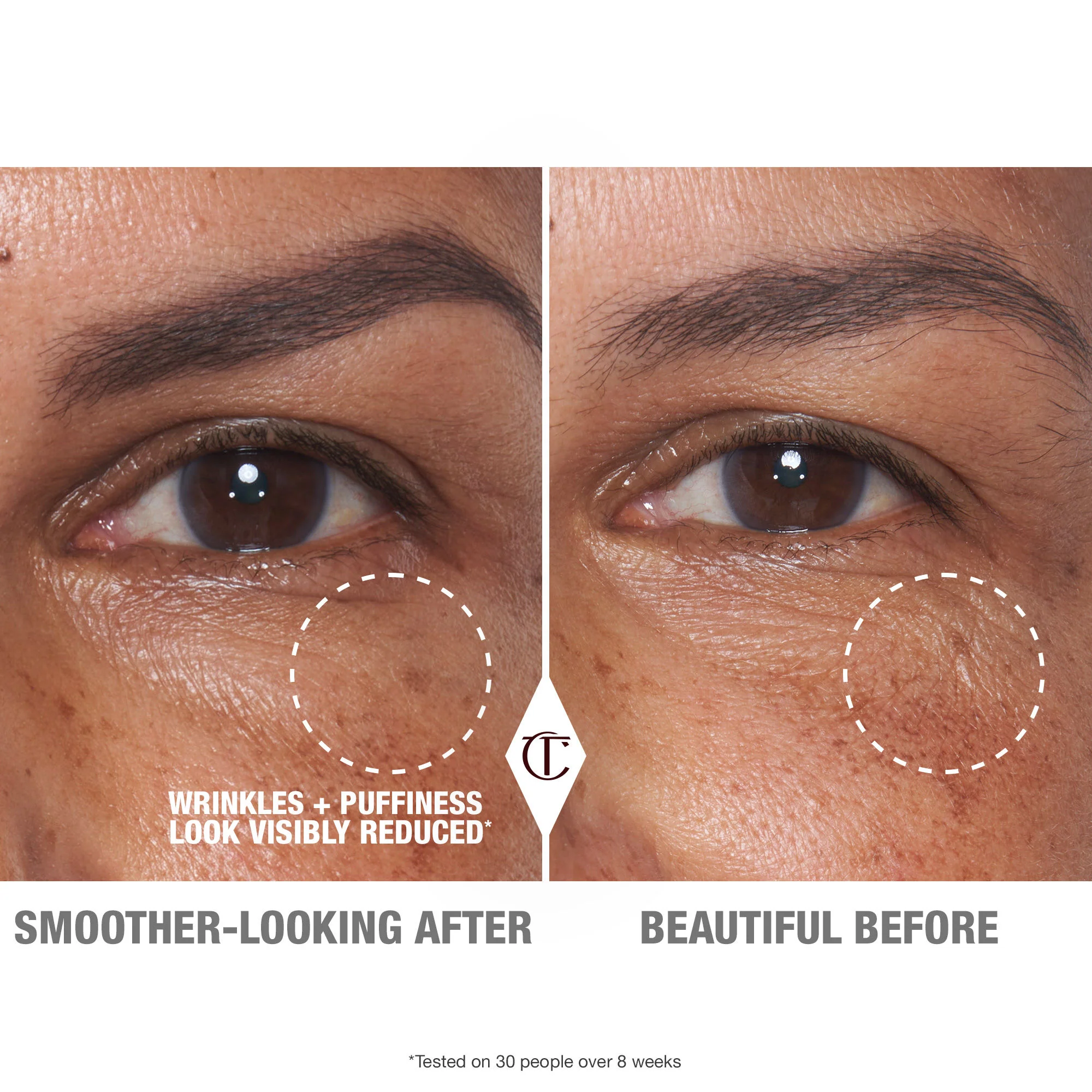 Cryo Recovery Eye Serum - Image 3