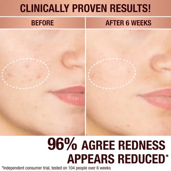 Dark Spot Correcting Radiance Recovery Serum - Image 6