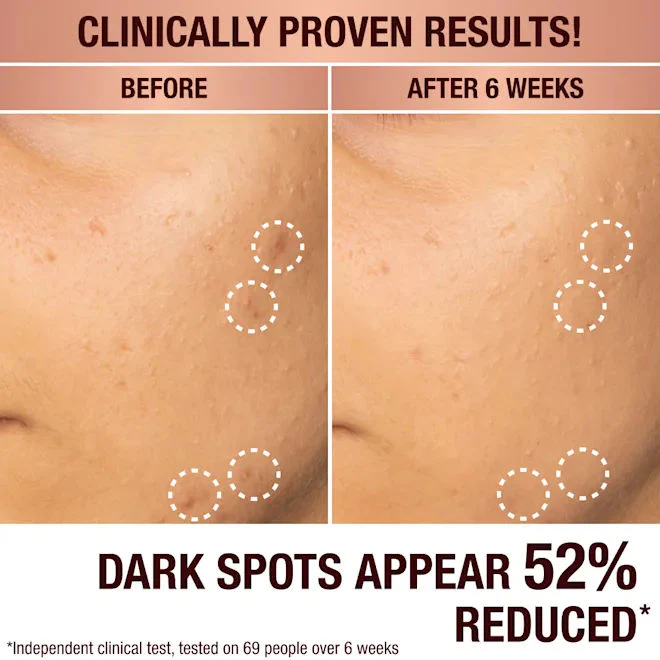 Dark Spot Correcting Radiance Recovery Serum - Image 4