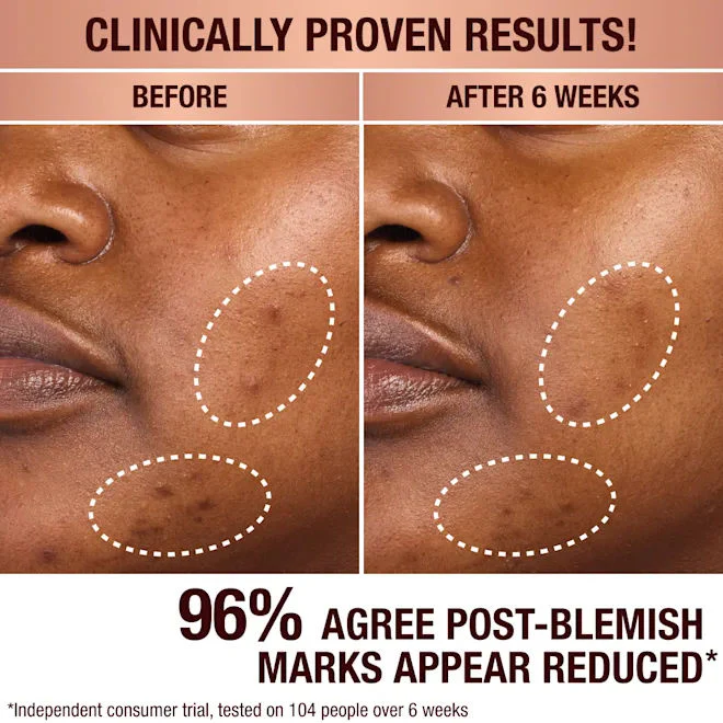 Dark Spot Correcting Radiance Recovery Serum - Image 5