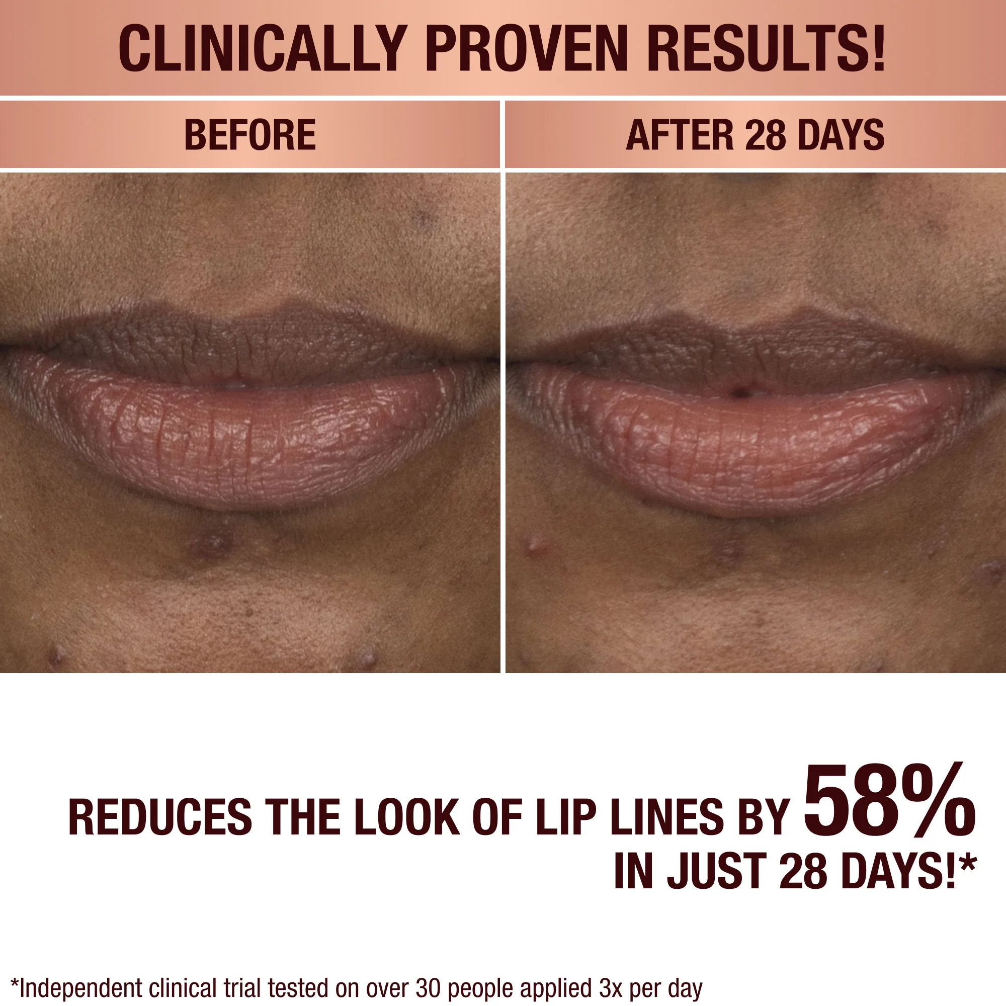 Life Changing Lip Mask - Image 9