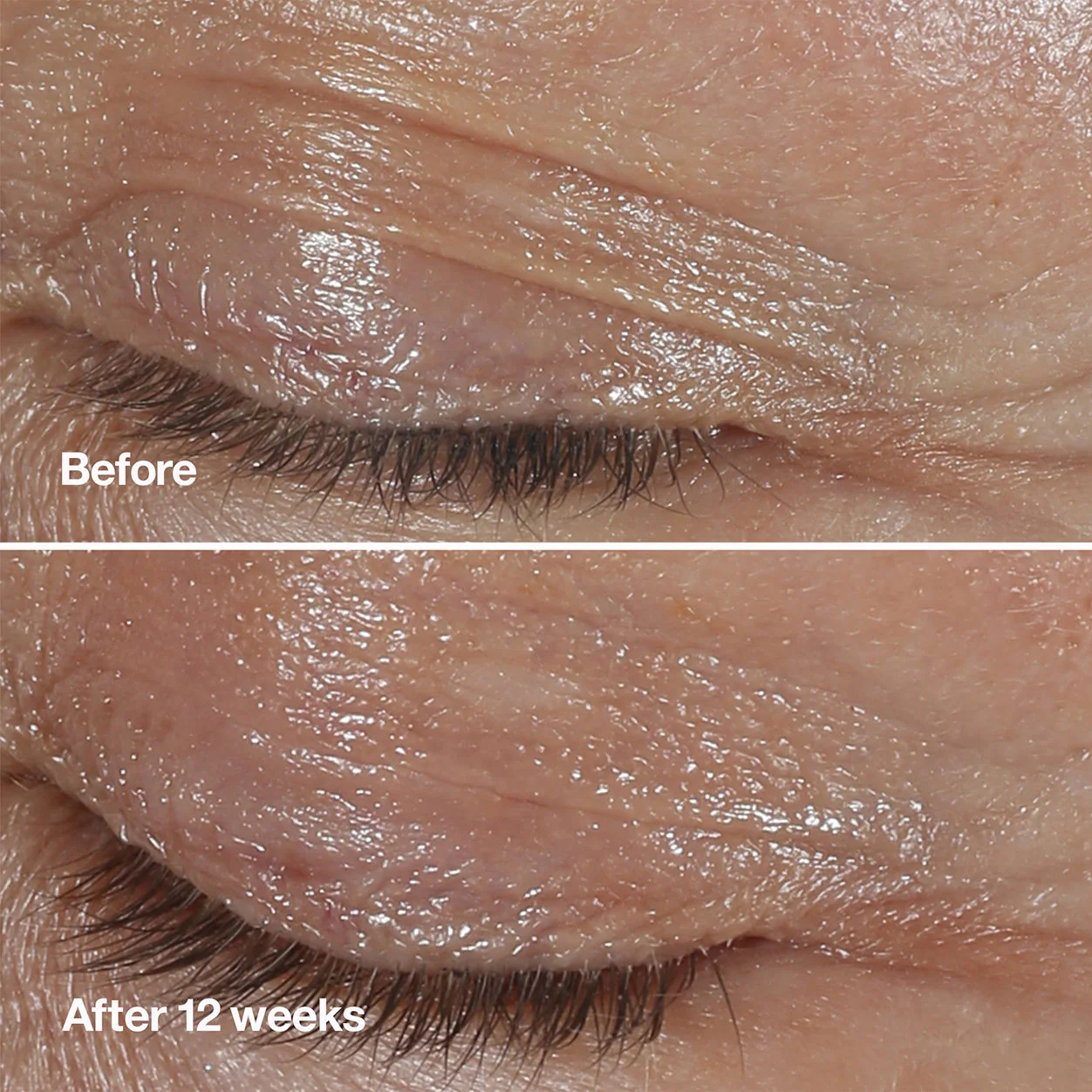 Smart Clinical Repair Wrinkle Correcting Eye Cream - Image 3
