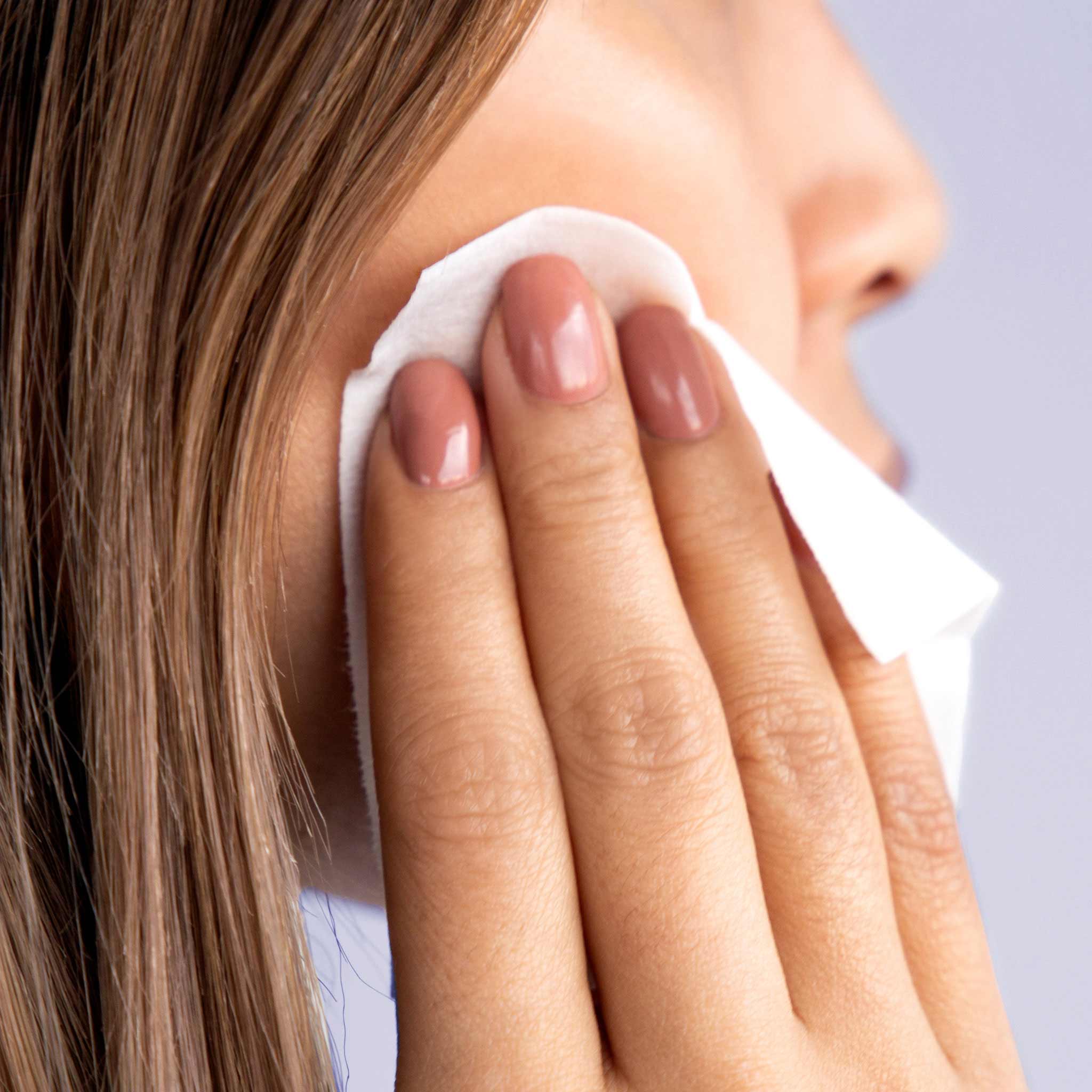 Perfect Peel - 10 Treatments - Image 10