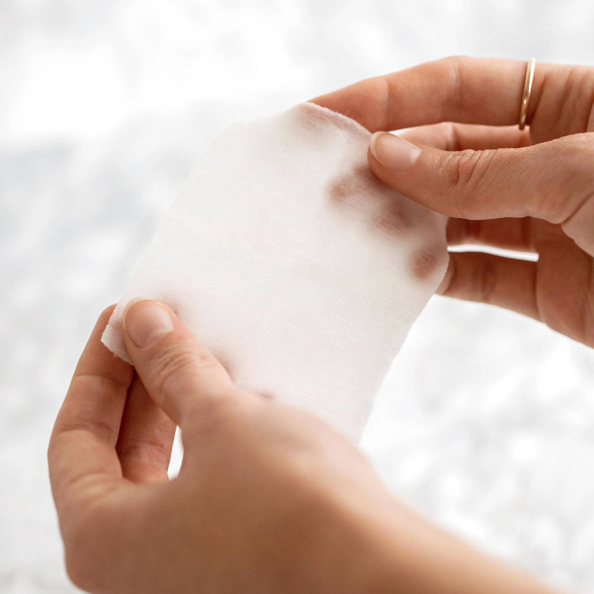 Perfect Peel - 10 Treatments - Image 11
