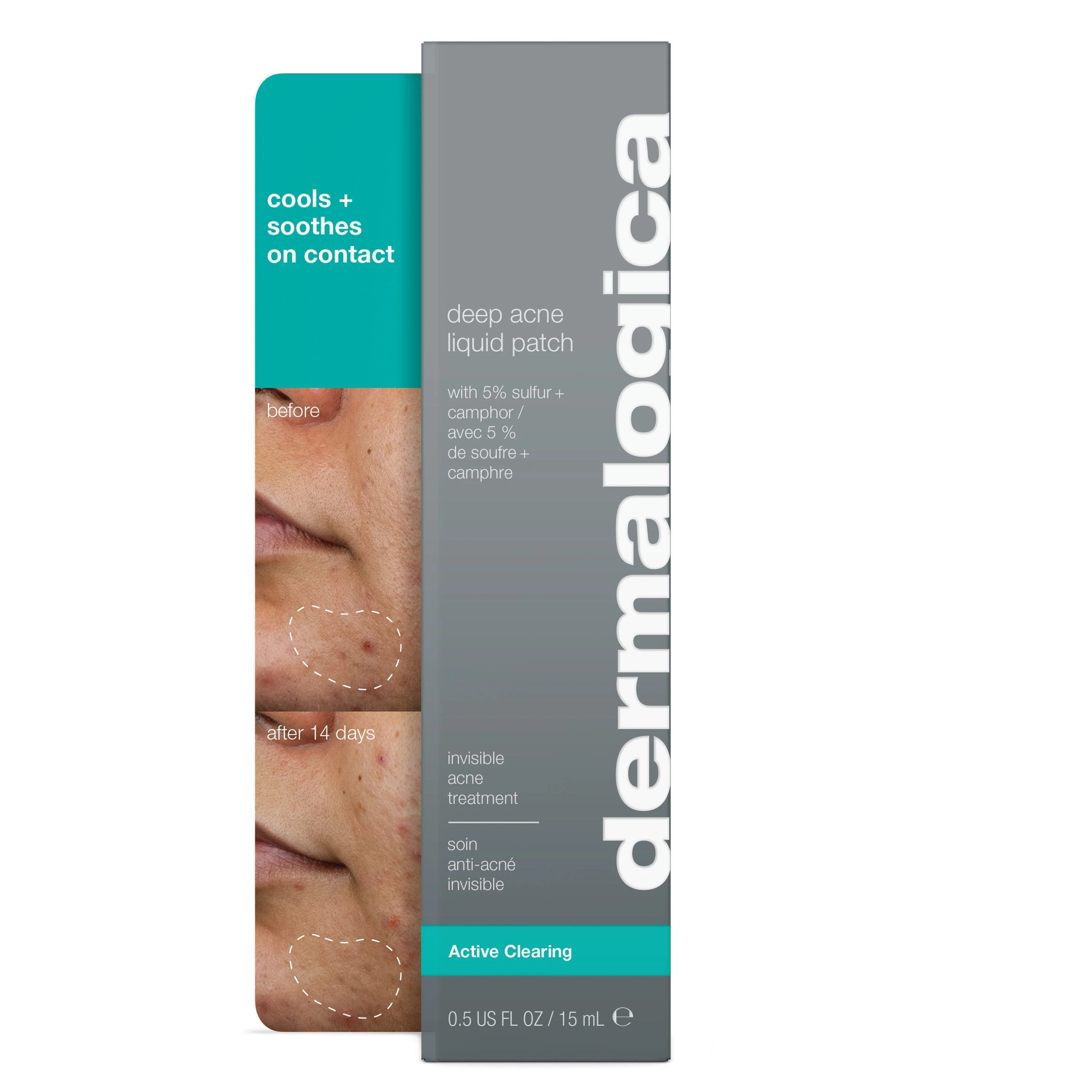 Deep Acne Liquid Patch - Image 2