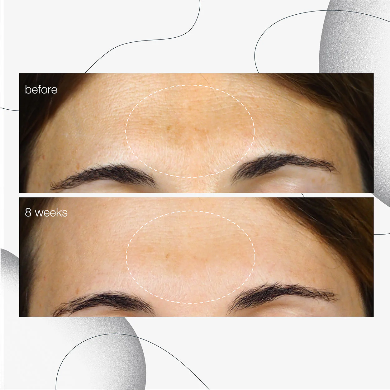 PowerBright Dark Spot Serum - Image 2