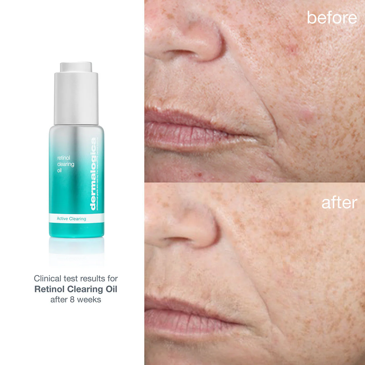 Retinol Clearing Oil - Image 2