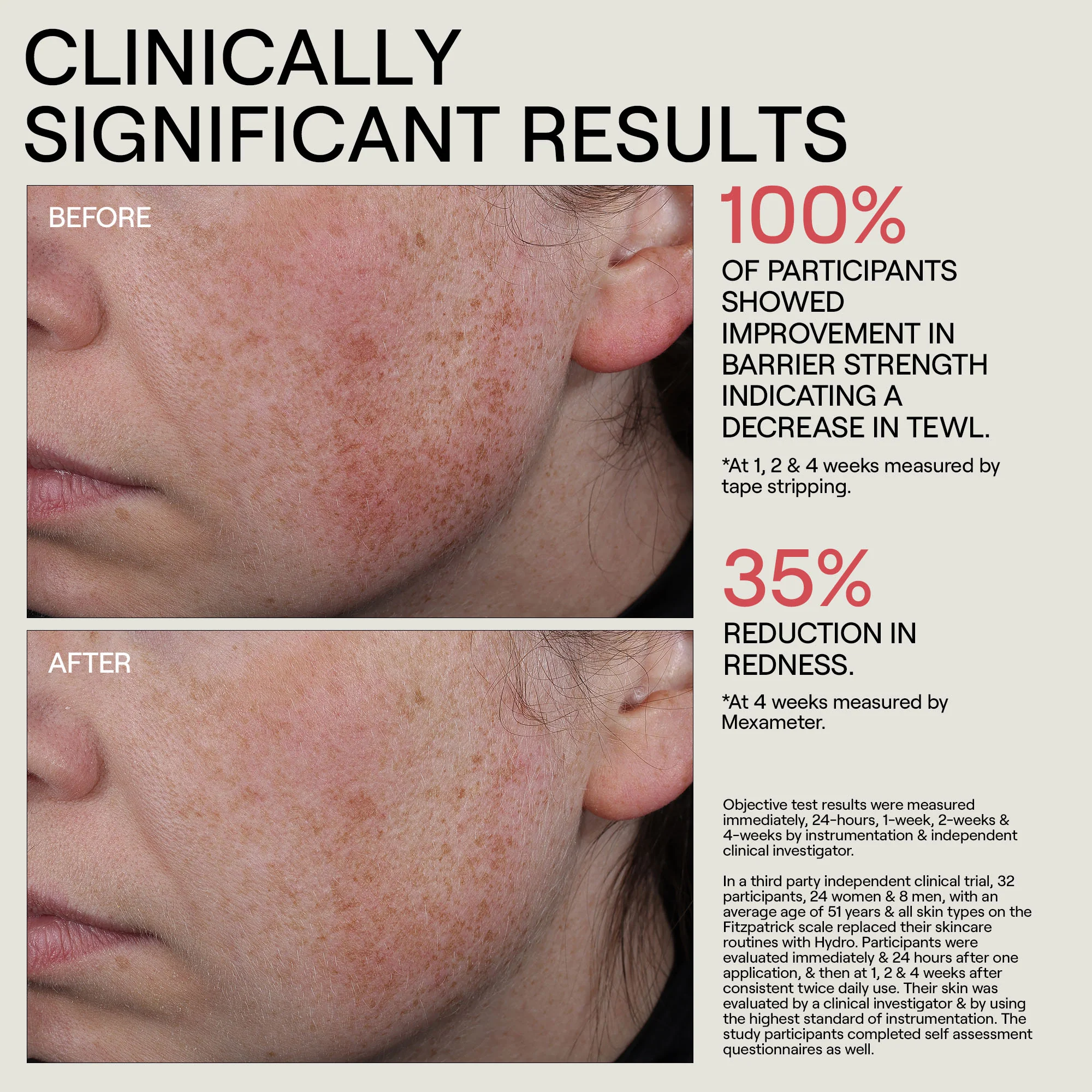HYDR/O Bioactive Hydrolipid Barrier Moisturizer - Image 3