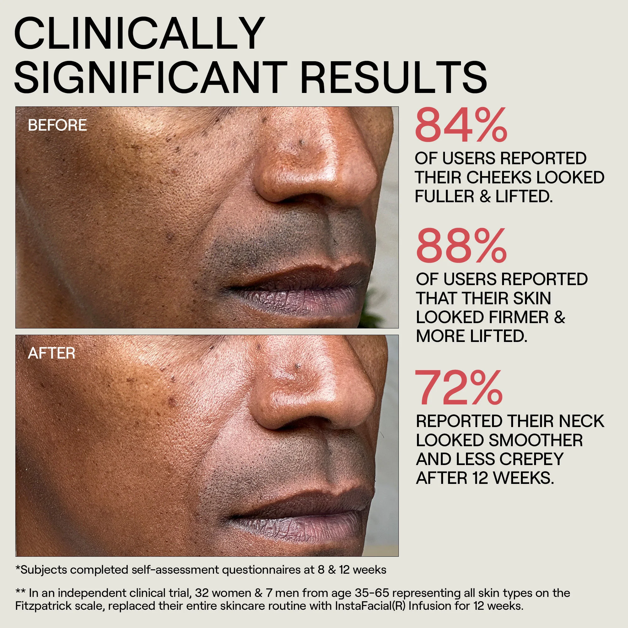 Instafacial Infusion Biomimetic Microcollagen Matrix - Image 7