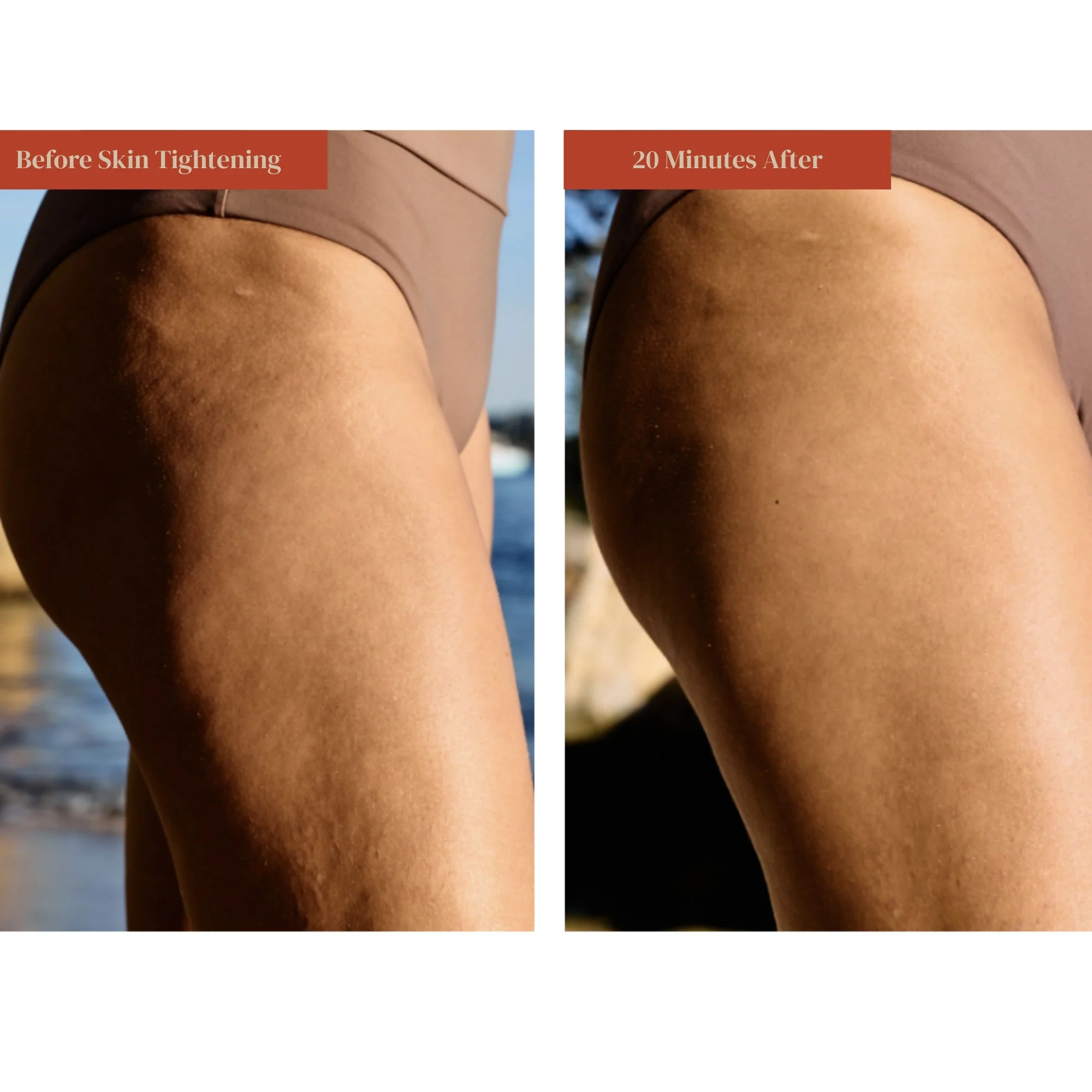 Skin Tightening + SPF 30 - Image 3