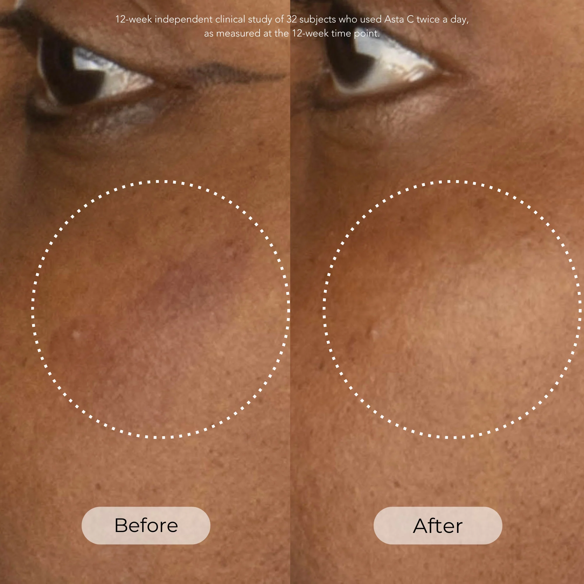 Asta C Vitamin C Age Defense Serum - Image 2