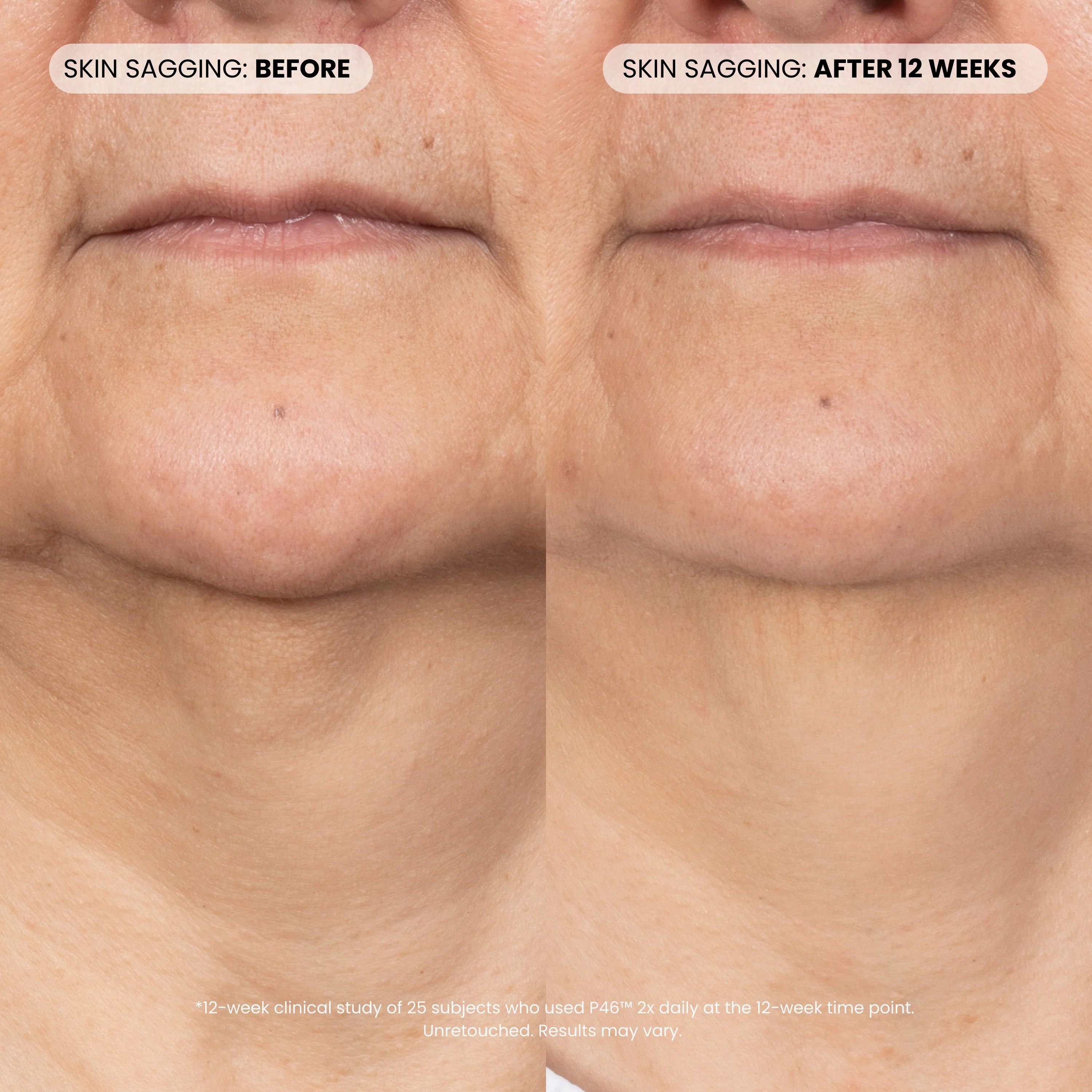 P46 Peptide + HA Plumping Serum - Image 4