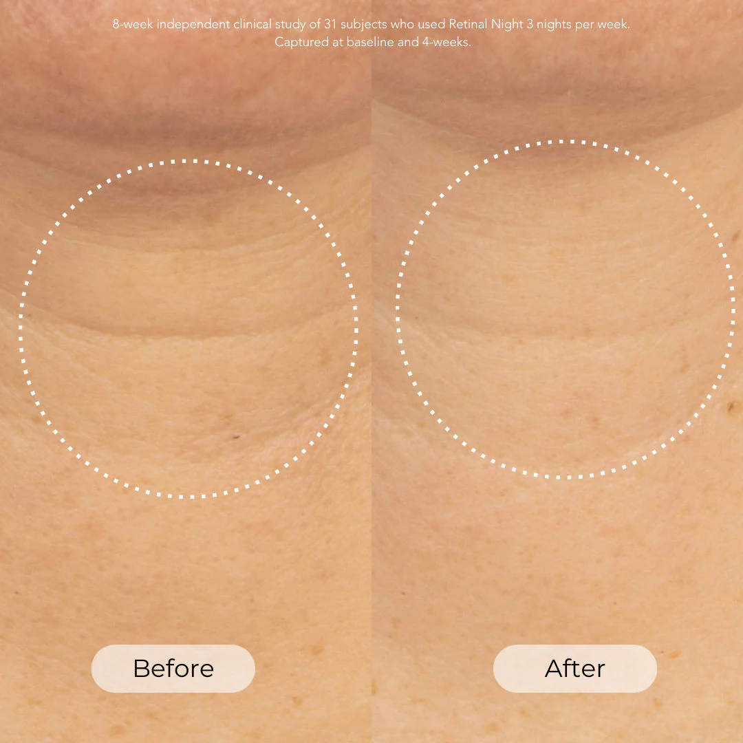 Retinal Night Advanced 0.1% Retinal Firming Treatment - Image 2