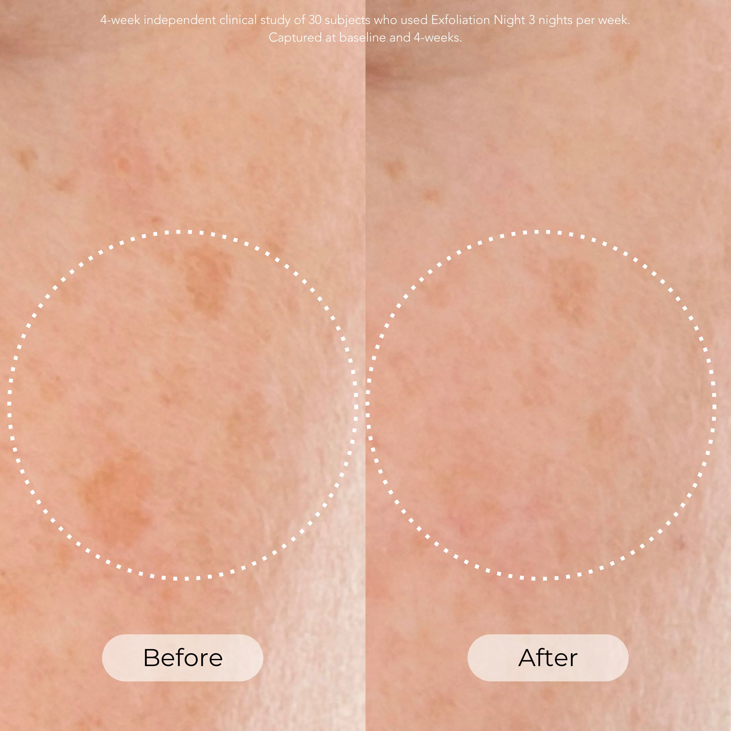 Skin Cycling Program - Image 4