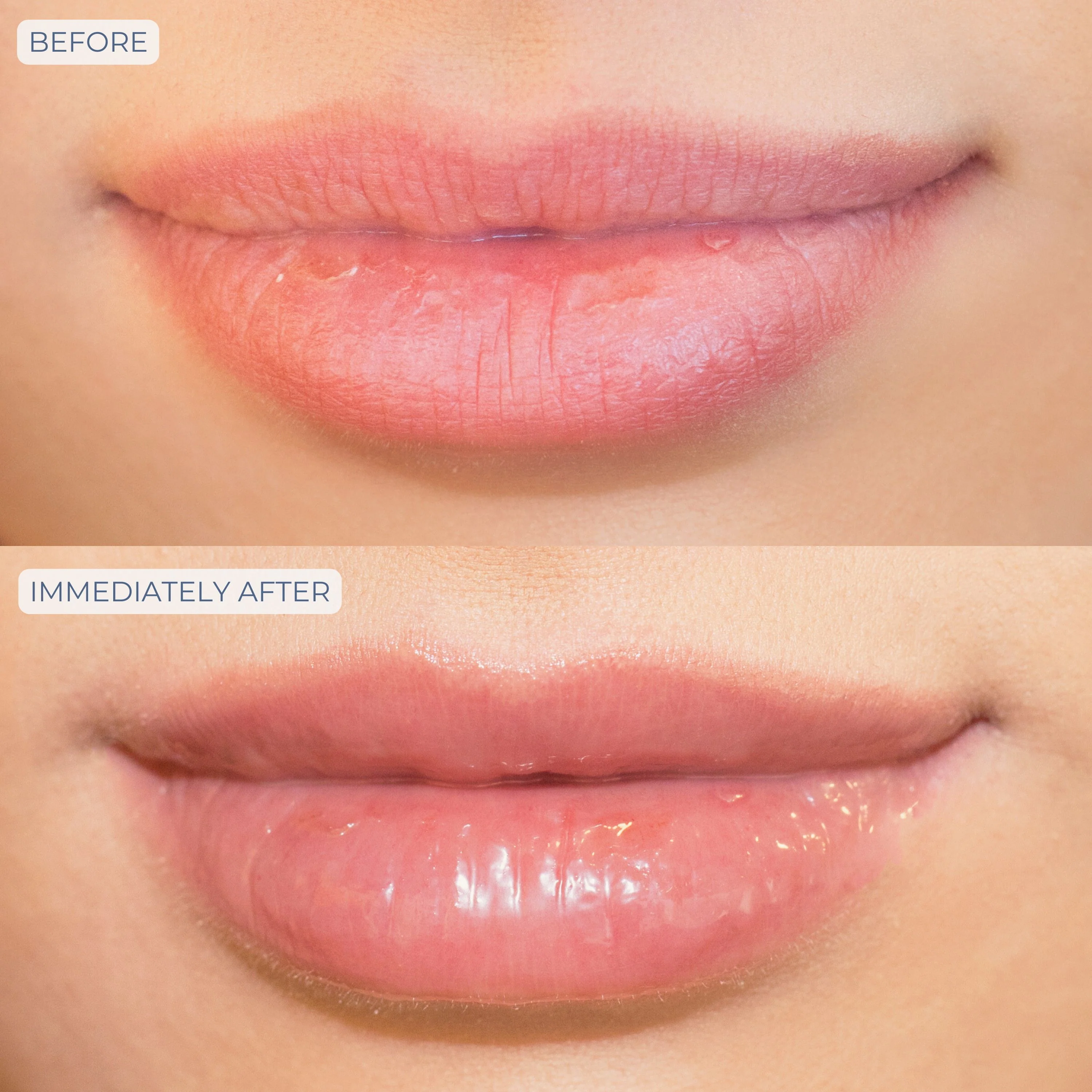 Tri-Liptide Peptide Lip Enhancing Treatment - Image 4
