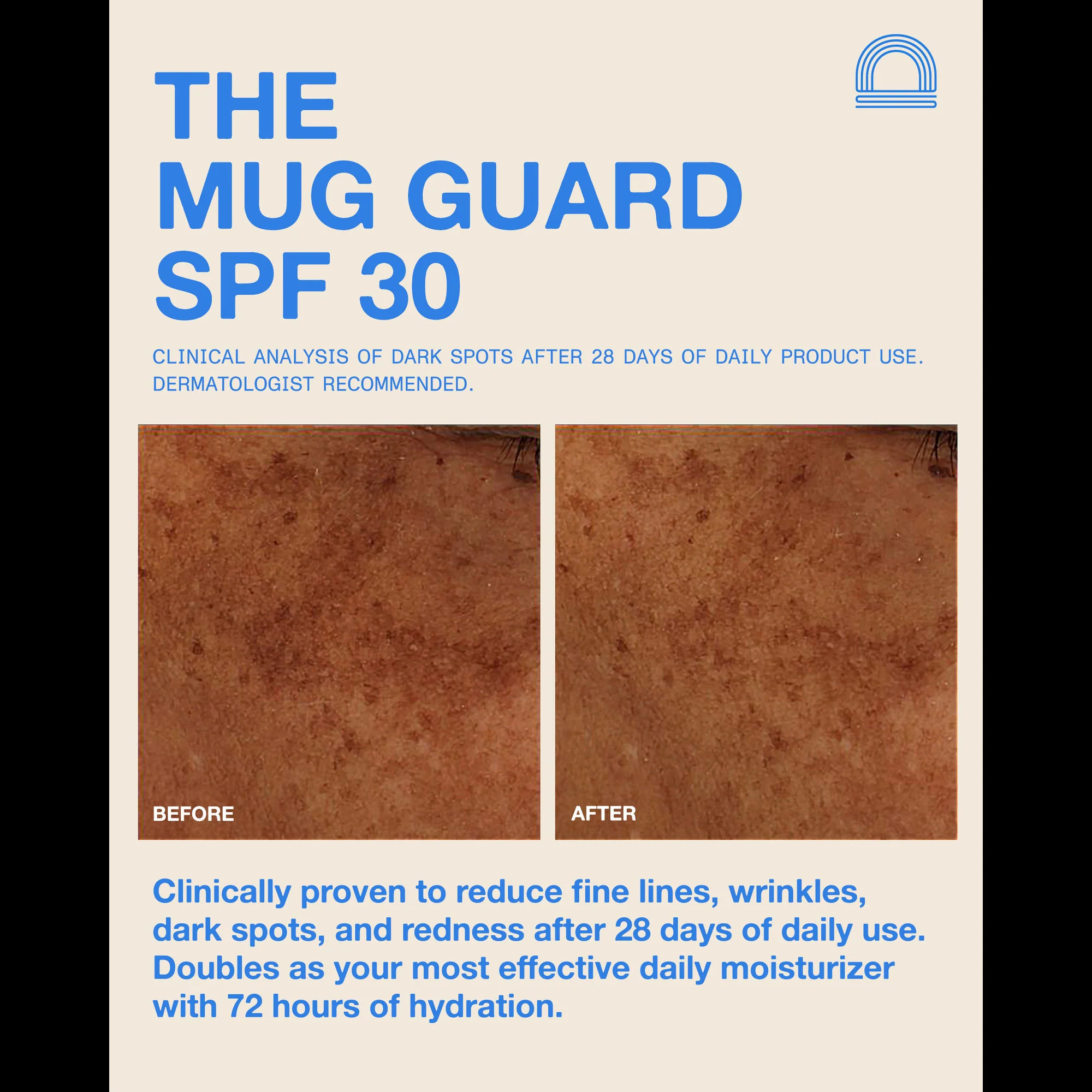 The Mug Guard SPF 30 - Image 7