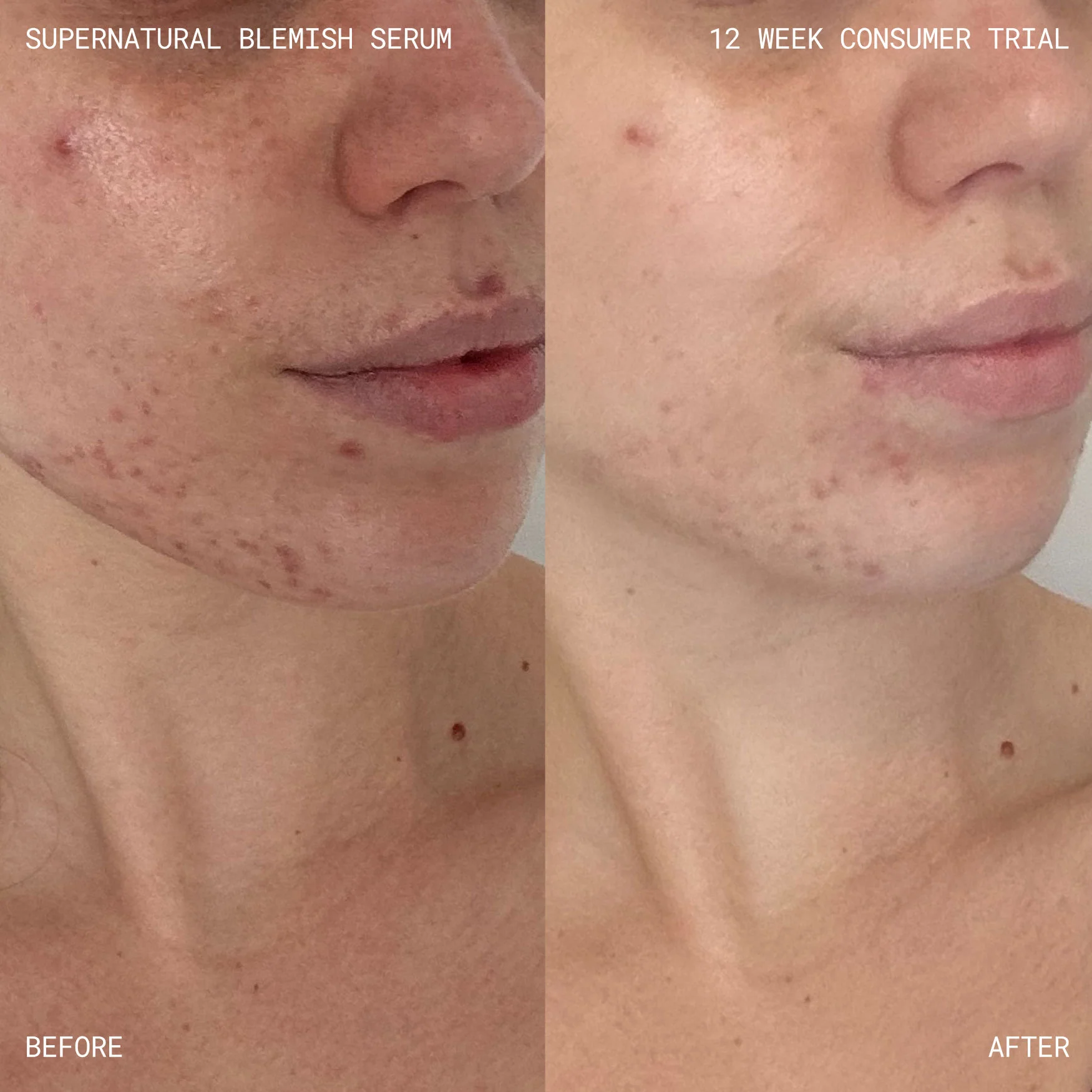Supernatural Blemish Face Serum - Image 5