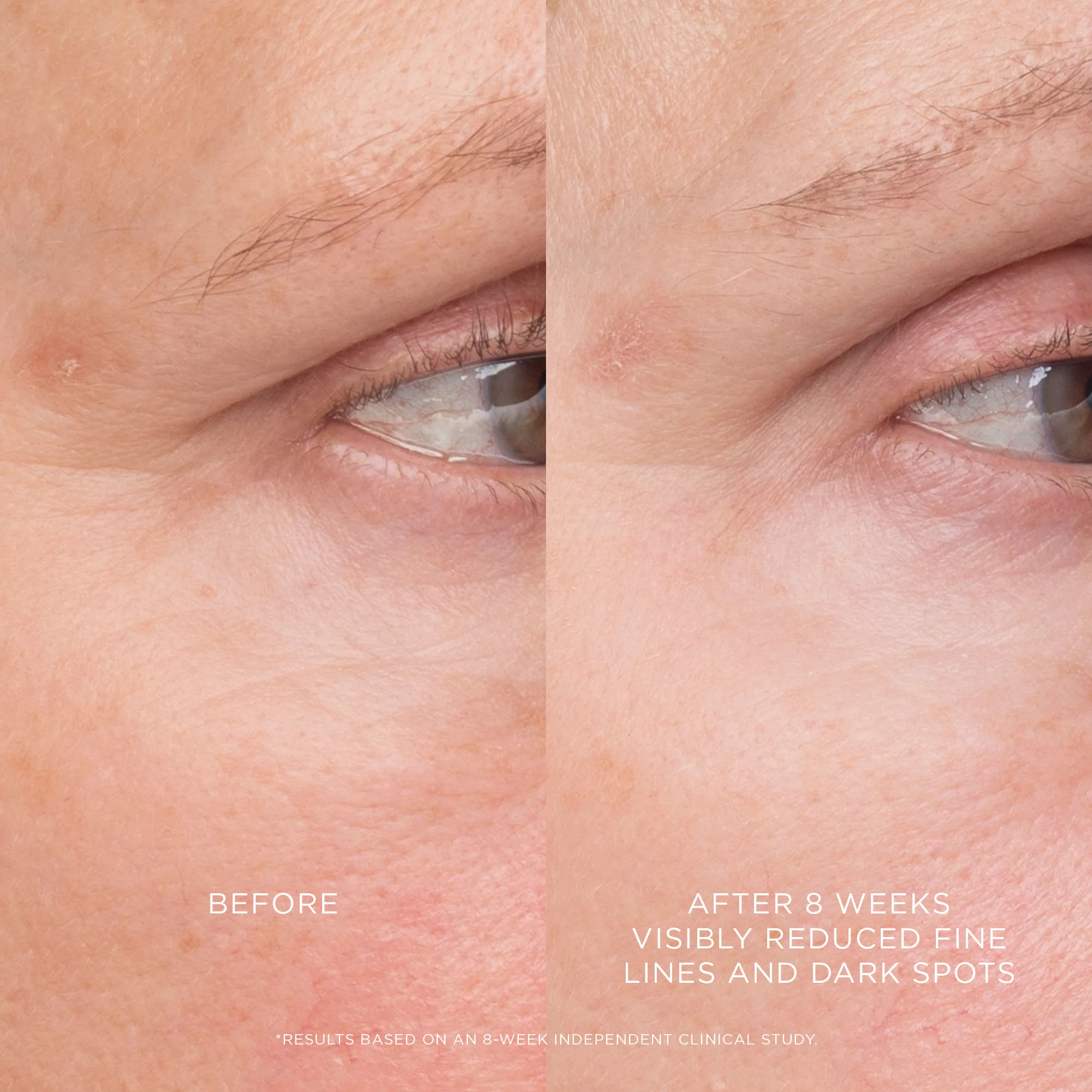 Equilibrium Resurfacing Retinoid Treatment - Image 3