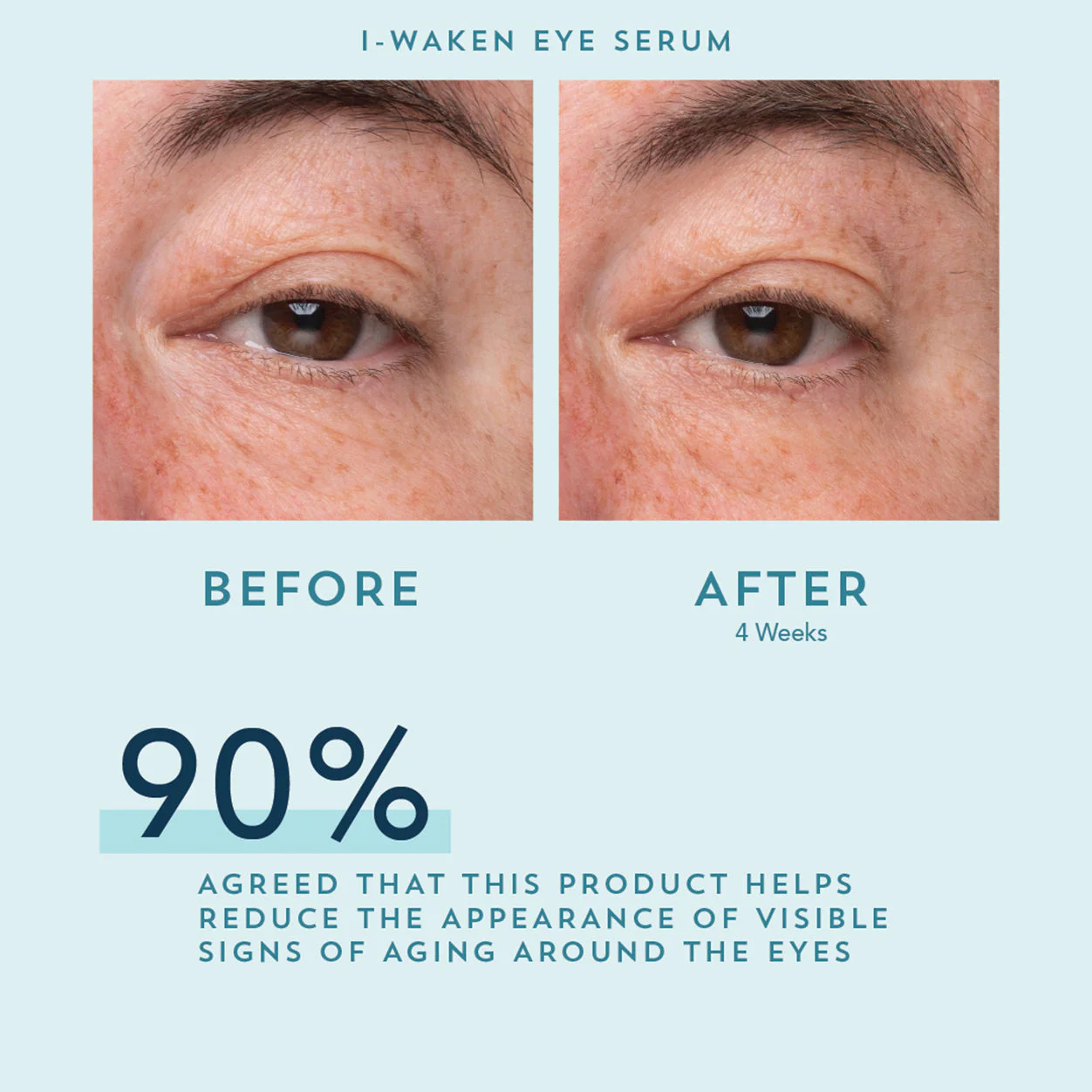 I-Waken Eye Serum - Image 5