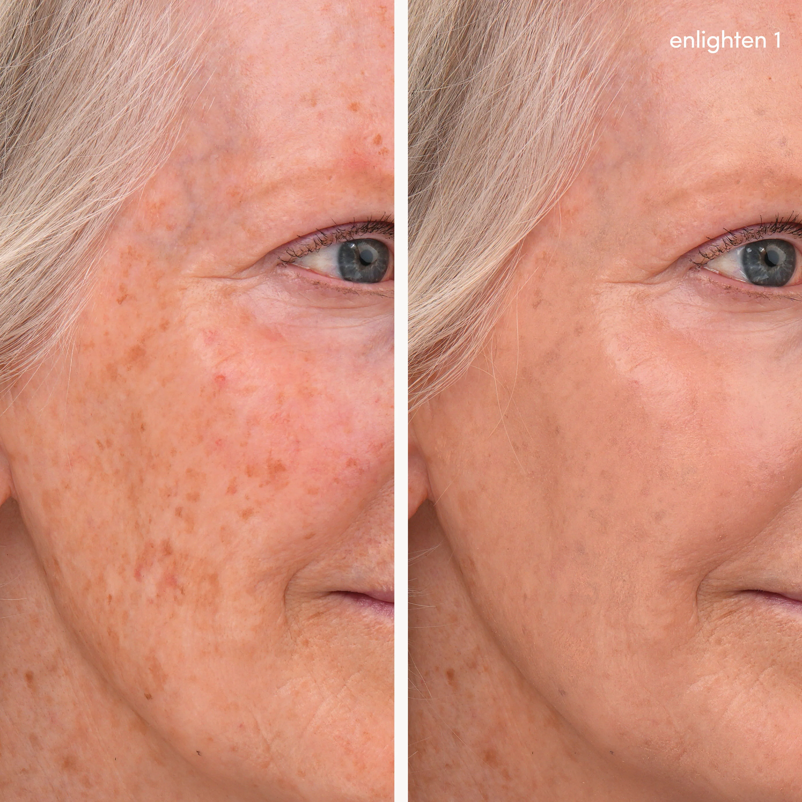 Enlighten Plus Under-Eye Concealer - Image 14