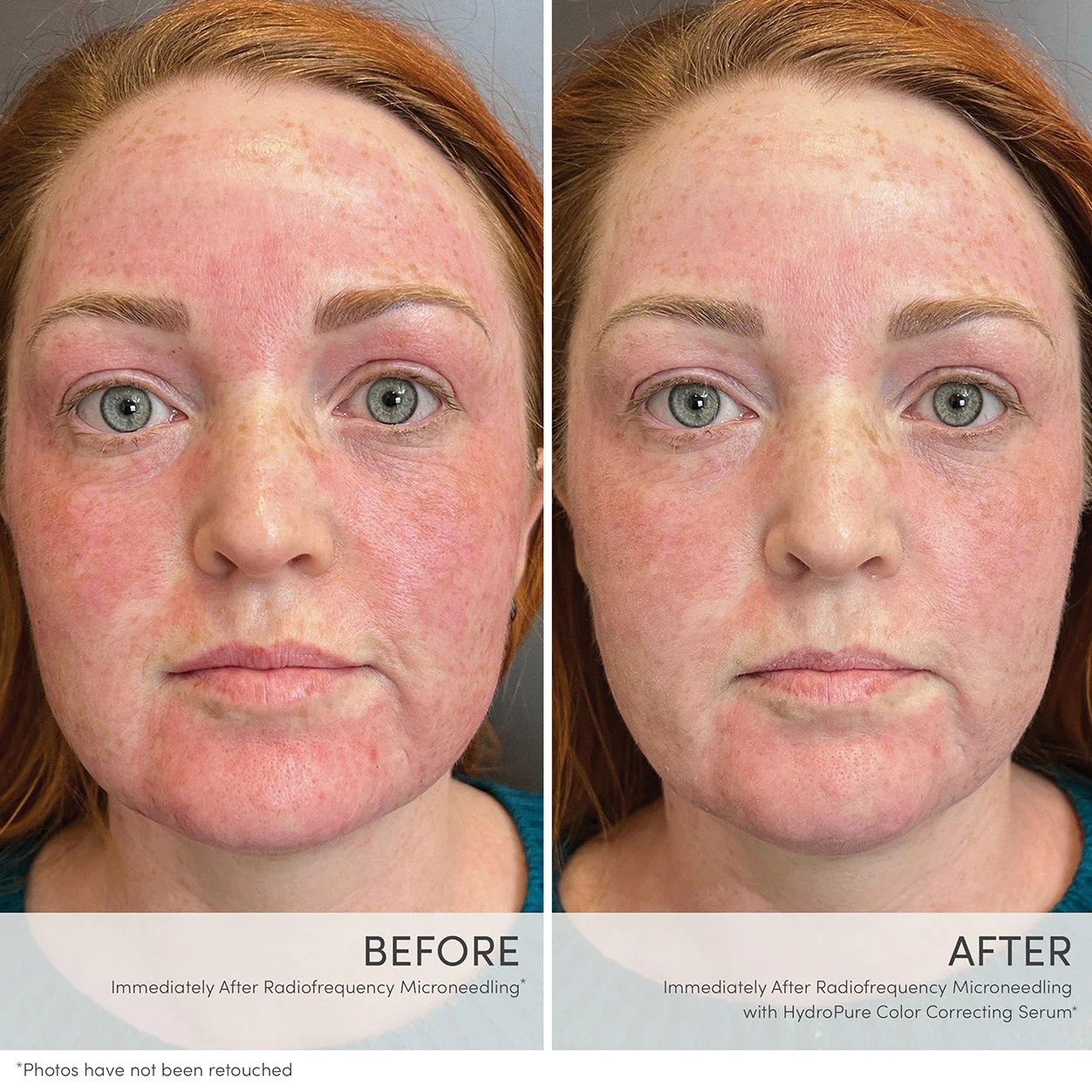 HydroPure Color Correcting Serum with Hyaluronic Acid and CoQ10 - Image 3
