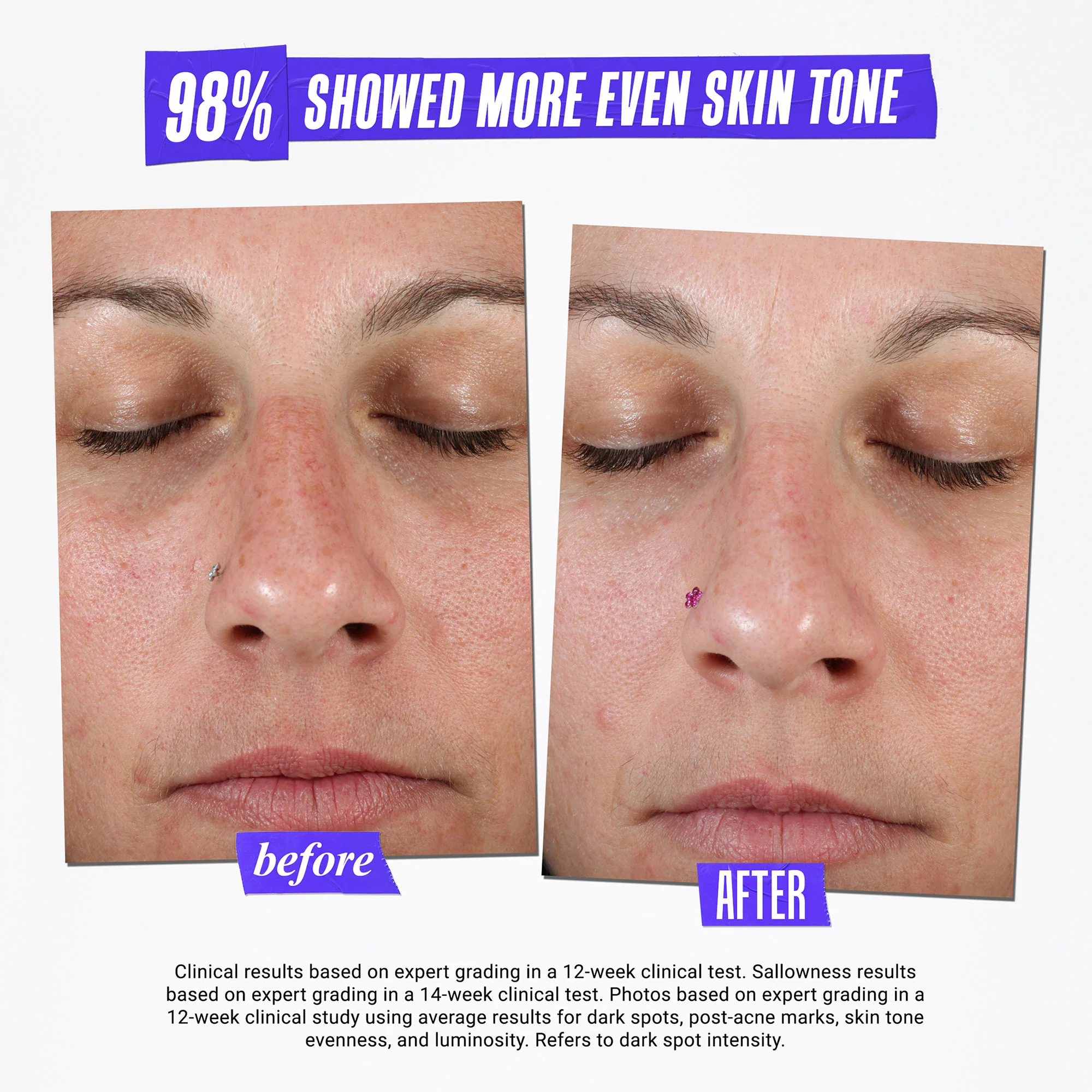 Clearly Corrective Dark Spot Solution - Image 5