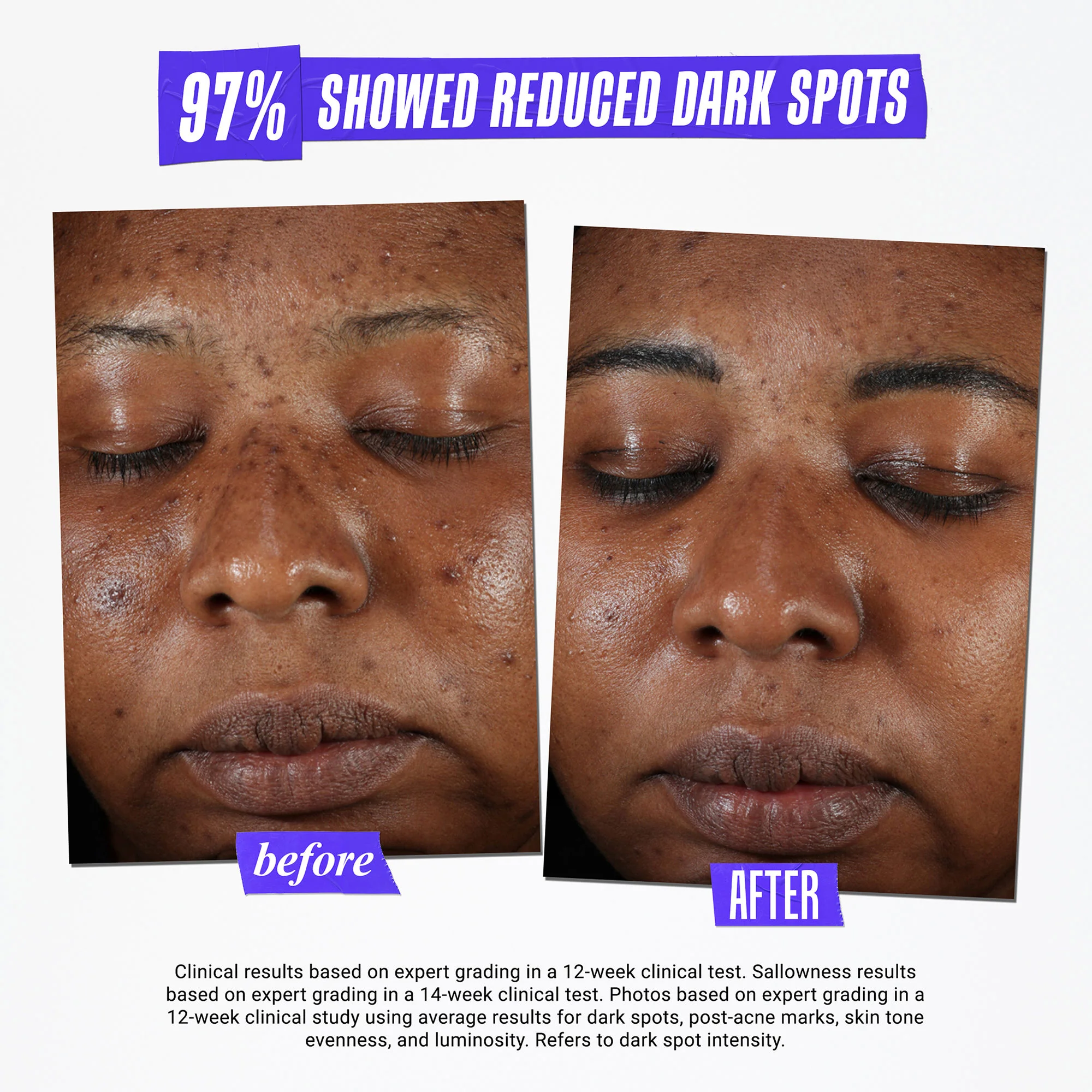 Clearly Corrective Dark Spot Solution - Image 6
